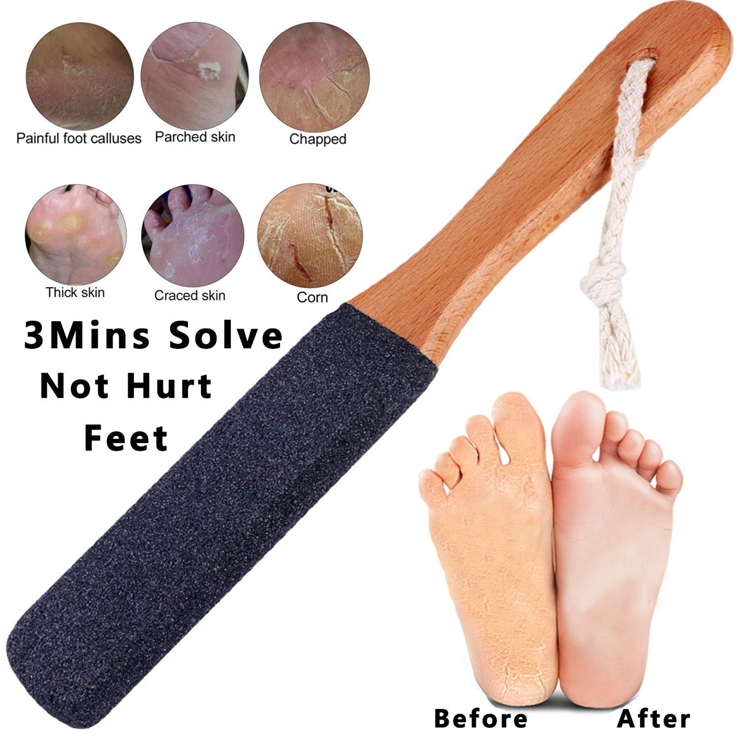 Kinepi Foot File Callus Remover Foot Scrubber,Professional Pedicure Foot Rasp Removes Cracked Heels,Dead Skin,Corn,Hard Skin,Pumice Stone for Scraper