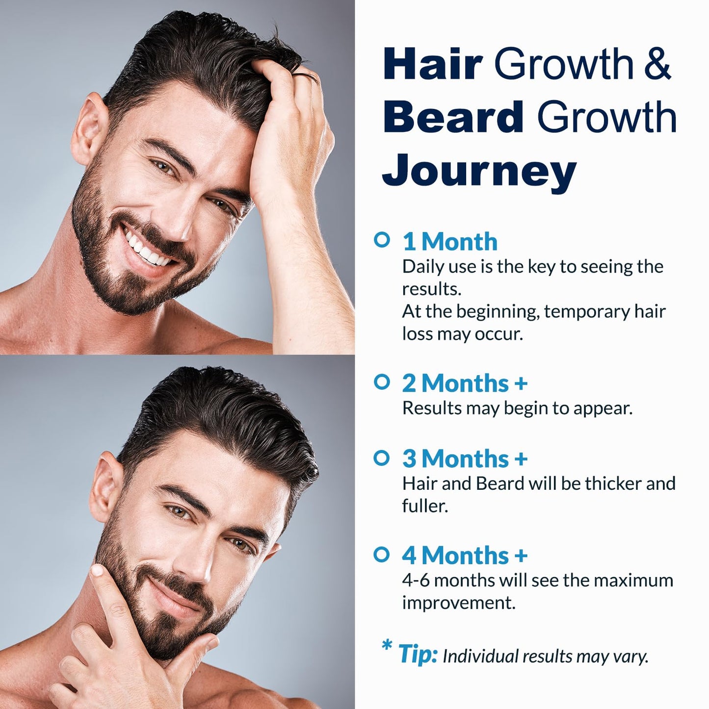 5% Minoxidil for Men Beard and Hair, Minoxidil for Women Hair Growth Spray with Biotin & Castor Oil, Strengthens Weak Roots, Repairs Thinning Hair Beauty and Personal Care FUZYAT