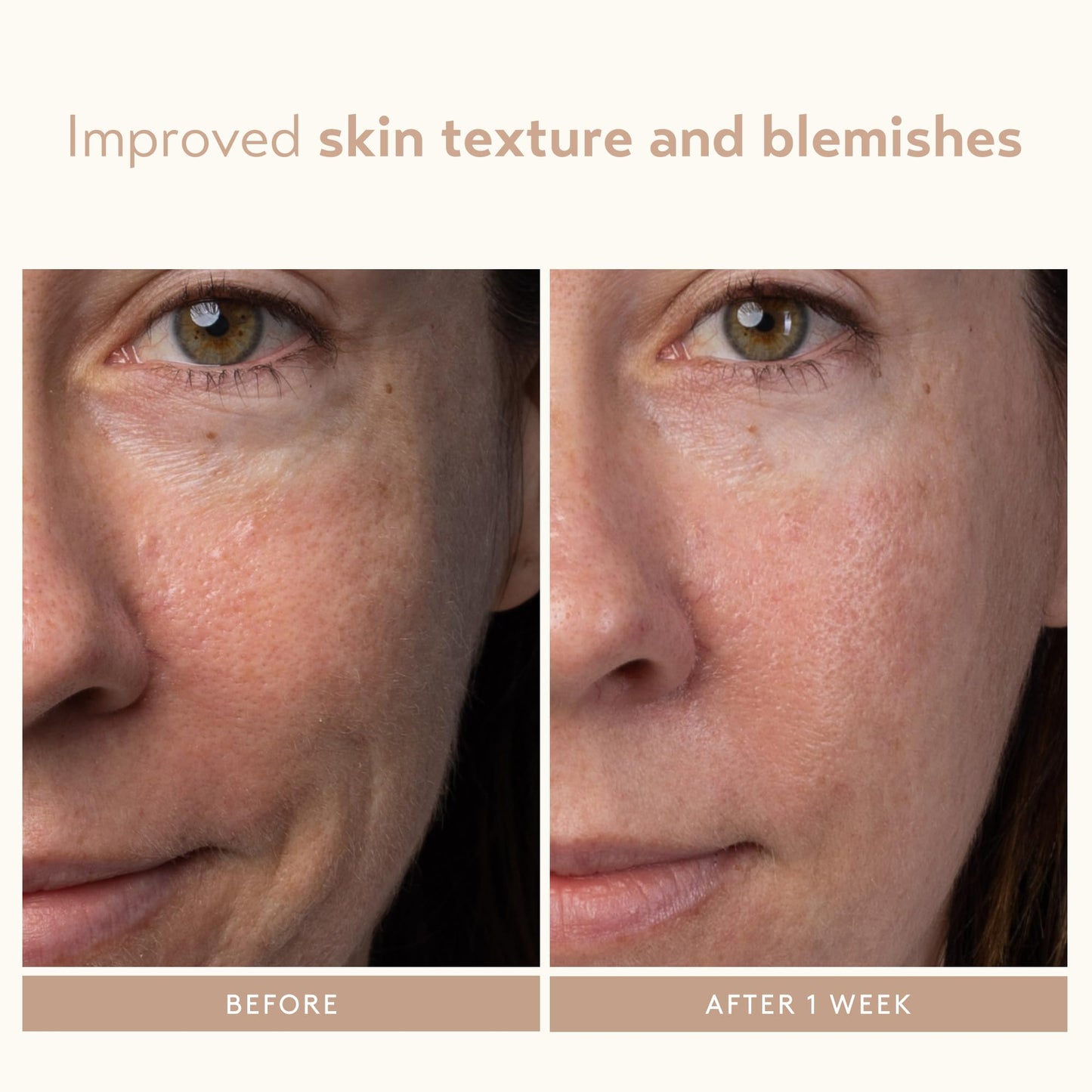 SHANI DARDEN SKIN CARE Lactic Acid Face Serum Travel Size, Active Night Serum to Help with the Look of Radiant and Smooth Skin, Gentle But Powerful