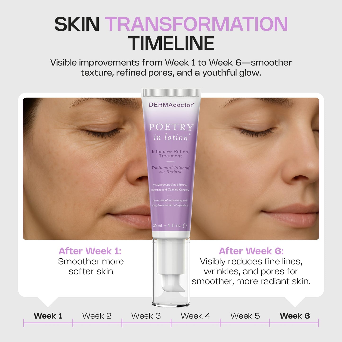DERMAdoctor Retinol Anti Aging Wrinkle Cream for Dark Spots, Uneven Skin Tone, Discoloration, Anti Wrinkle, Hydrating, Non Irritating, Aging Cream