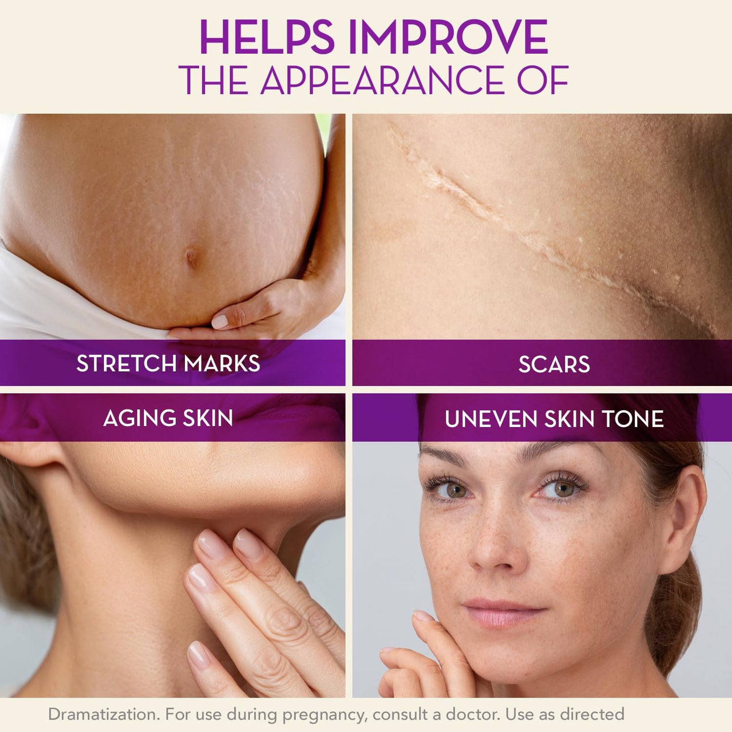 Cicatricure Cica Oil for Stretch Marks & Scars, Visible Results in 4 Weeks, Pregnancy Must-Haves Body Oil with Vitamin E, Stretch Mark Oil, Scar Beauty & Personal Care Cicatricure