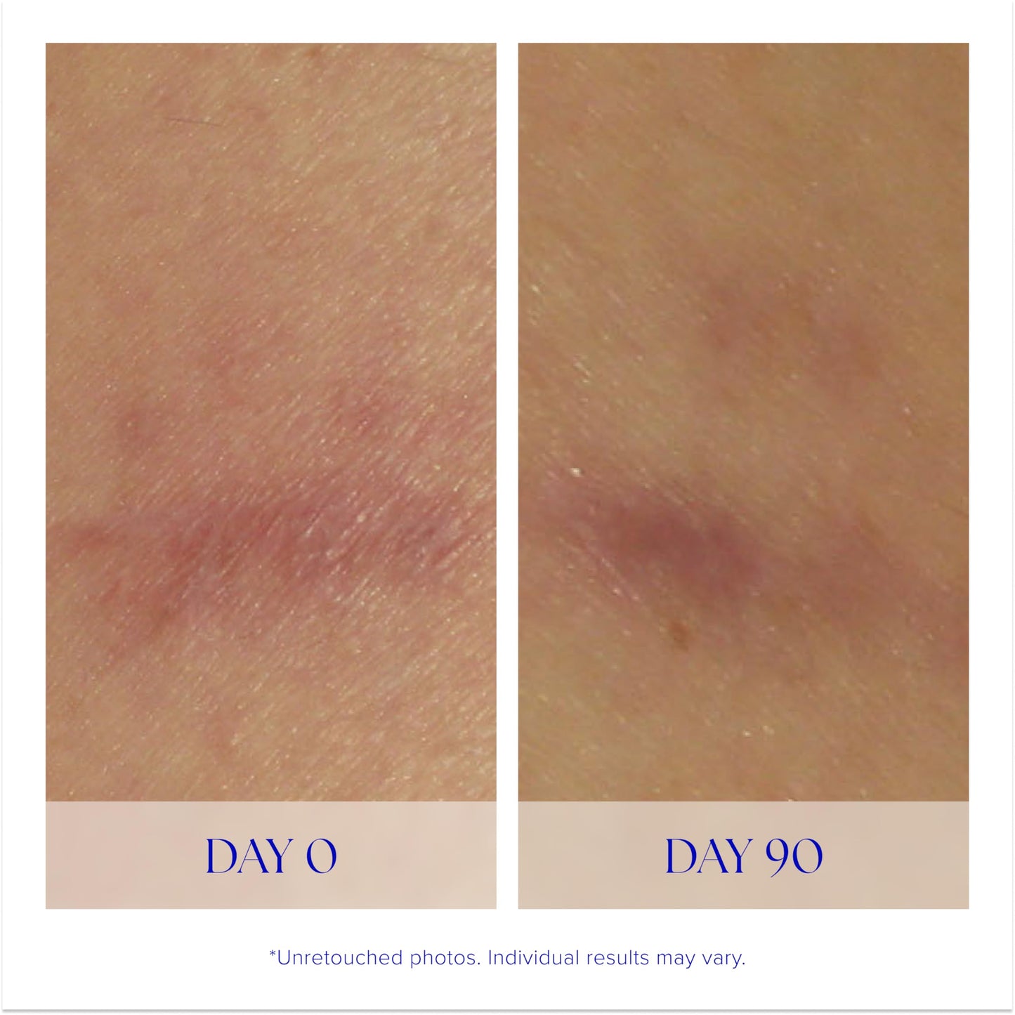 iS CLINICAL Super Serum Advance+, Anti-Aging Vitamin C Face Serum, reduces scaring and fine stretch marks, 0.5 Fl Oz