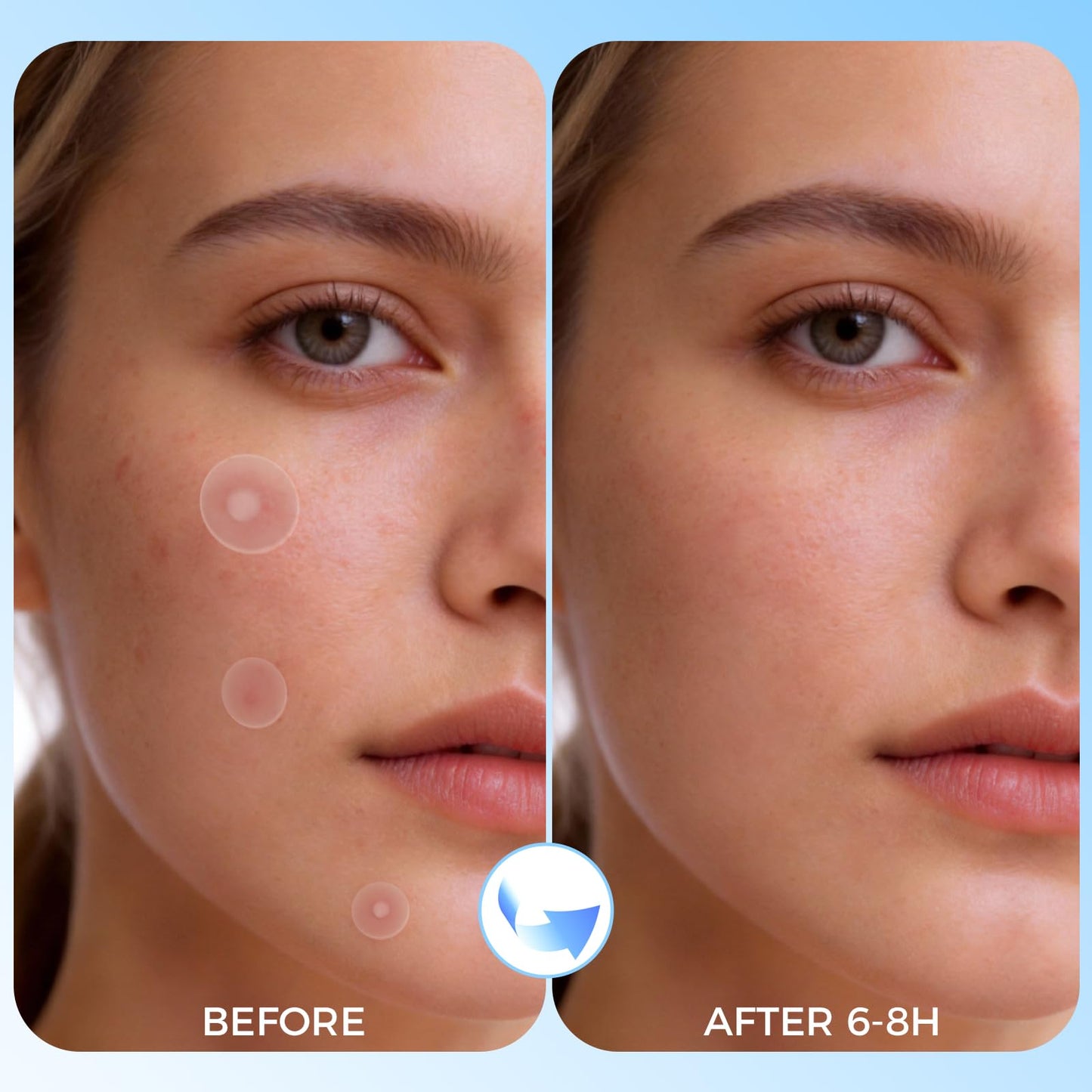 DATISEP Pimple Patches for Face, 640 Count Hydrocolloid Patch Acne Patches,4 Sizes Zit Patches for Covering, Blemishes and Breakouts, Dots Stickers Beauty and Personal Care DATISEP