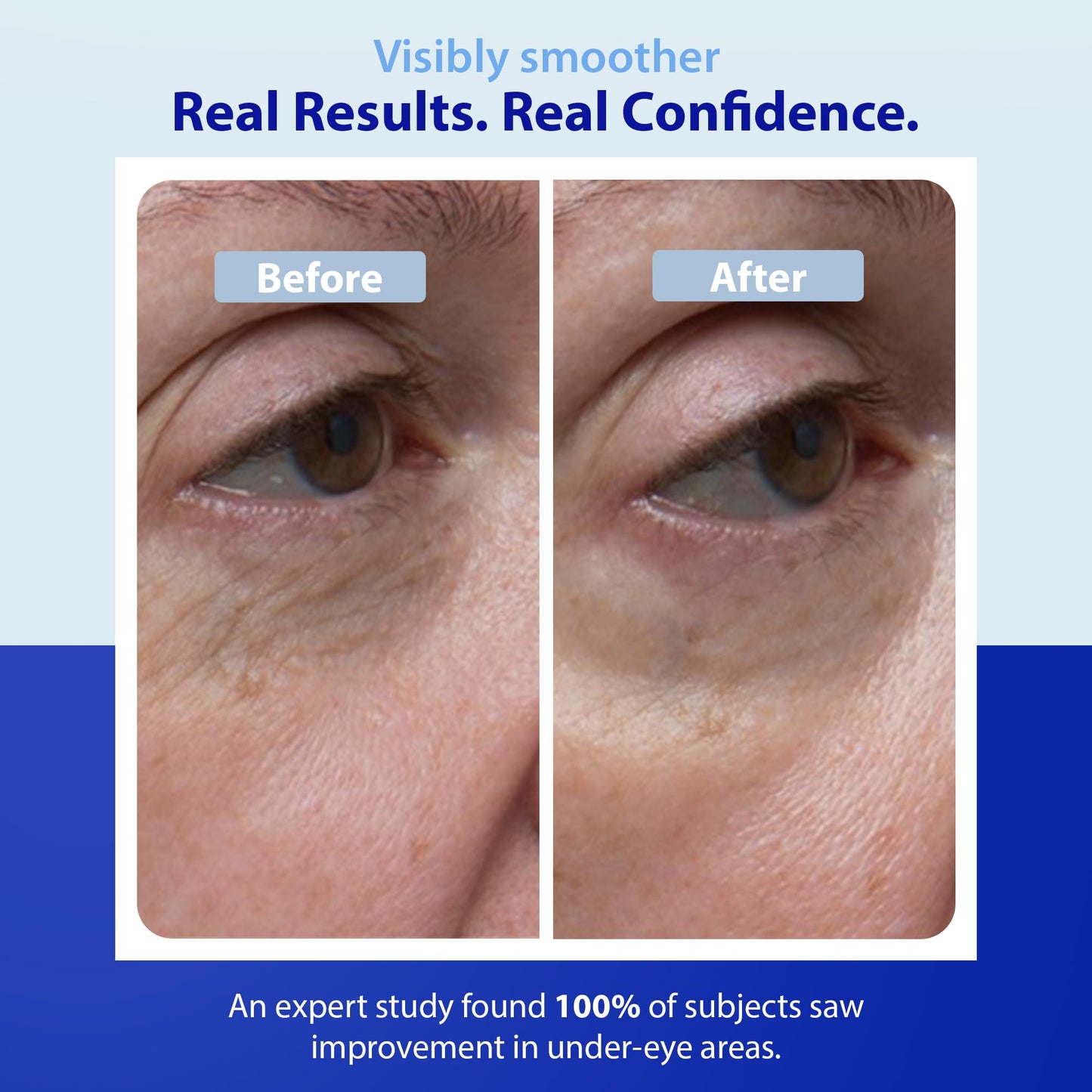 Dr. Denese SkinScience Firming Facial Collagen Eye Cream 0.5oz - Collagen, Hyaluronic Acid & Peptides for Smoother Under Eye Skin - Reduces Look