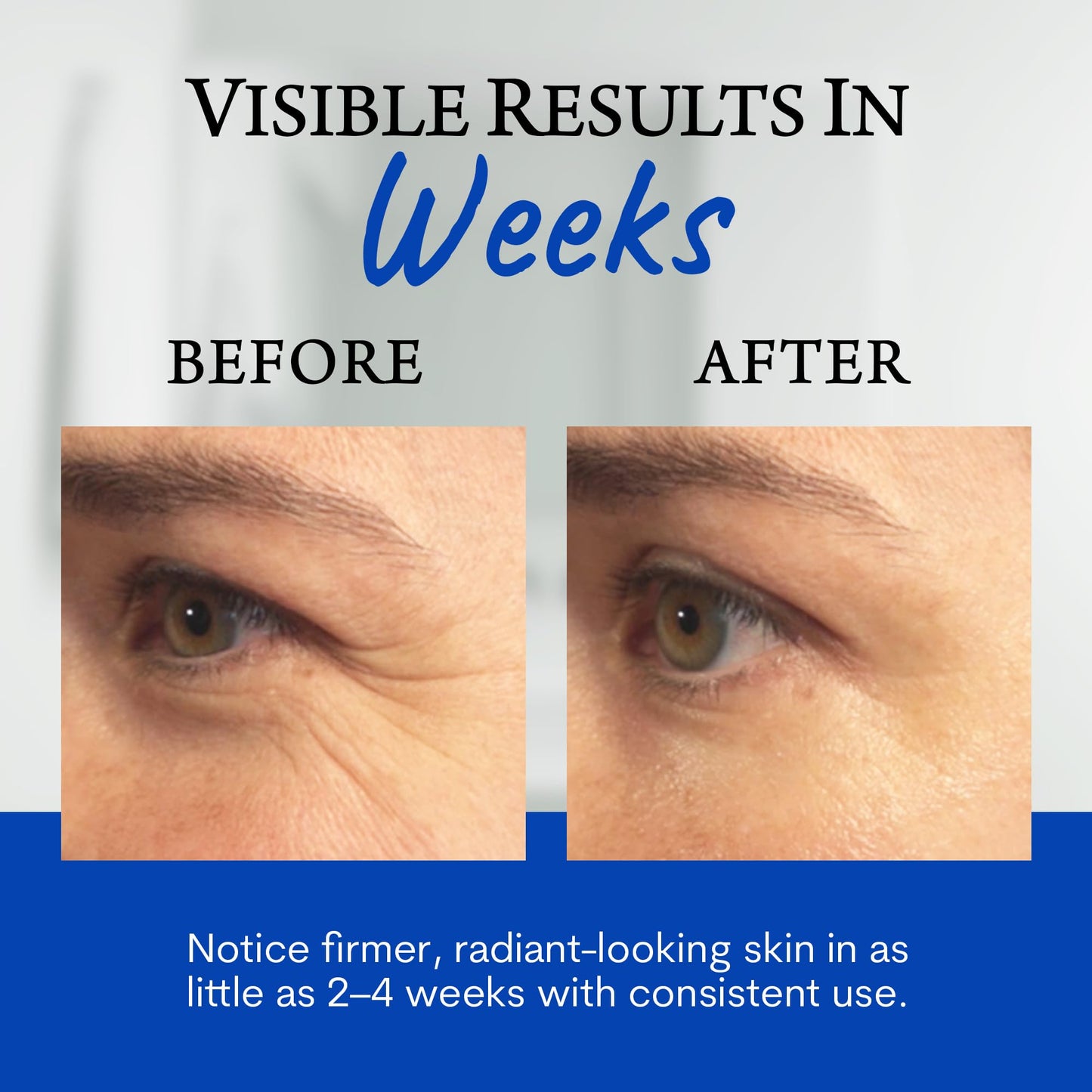 Biologic Sta-Tight Anti Aging Serum - Smoothing Face Serum for Women for Wrinkles and Fine Lines Around Eyes, Mouth & Forehead - Lifting & Firming