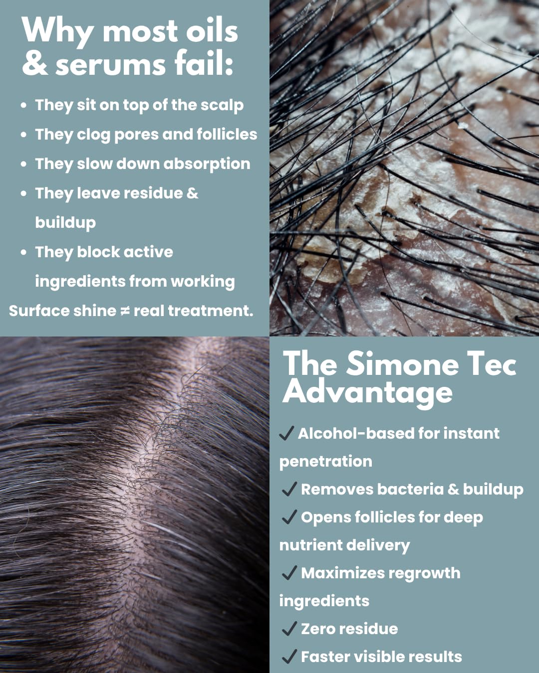 Simone Tec Hair Essentials Hair Loss Prevention Shampoo & Conditioner & Mask Set Capillary Proteins and Vitamins/Restore & Strengthens | Promo Dx2
