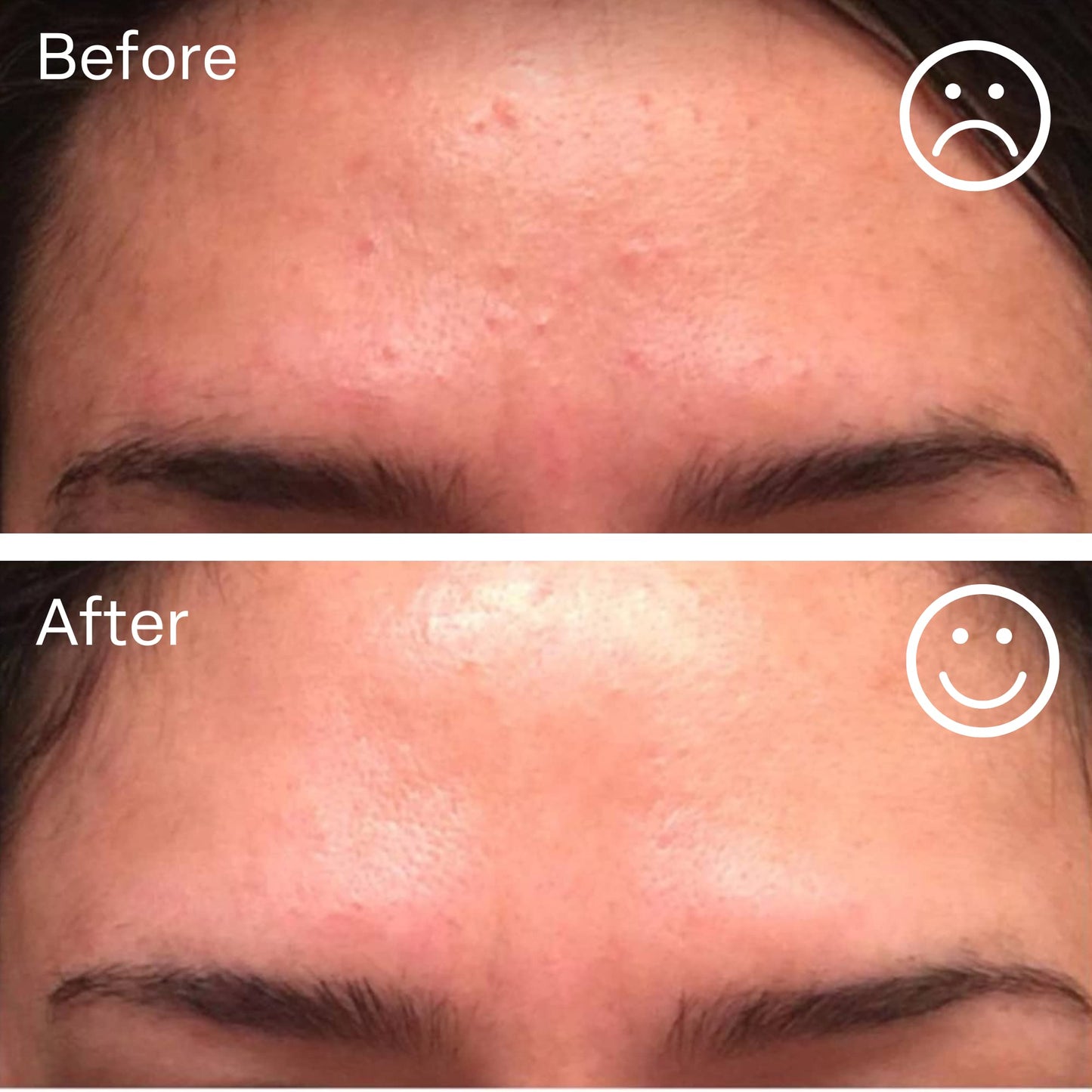 nuorganic Hyaluronic Acid + B5 + Plant Stem Cells: Skin Feels Hydrated, Plumper, Dewy and Rejuvenated - PhytoCellular Science + Multi Molecular + 100