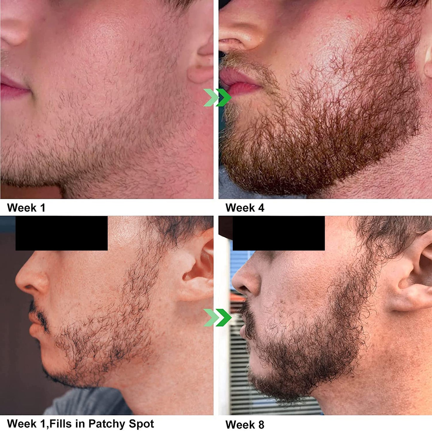 Unscented Beard Oil - Natural, Non-GMO, Facial Hair Hydrating & Conditioning Oil Blend - 32 oz - Bulk Sized, Promoting Growth and Silky Smooth Hair