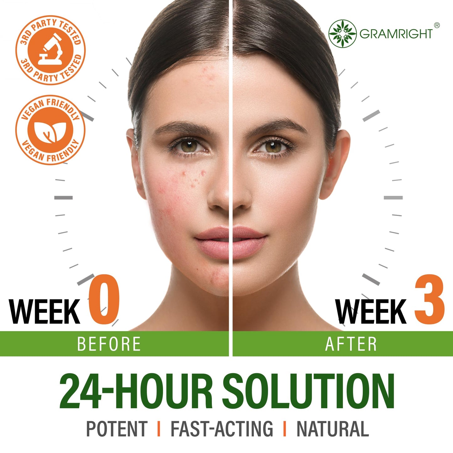 Acne Face Cream - Acne Spot Treatment for Face & Acne Dots - Tea Tree Oil & Salicylic Acid - Natural Cystic Acne Treatment - Made in USA - For All