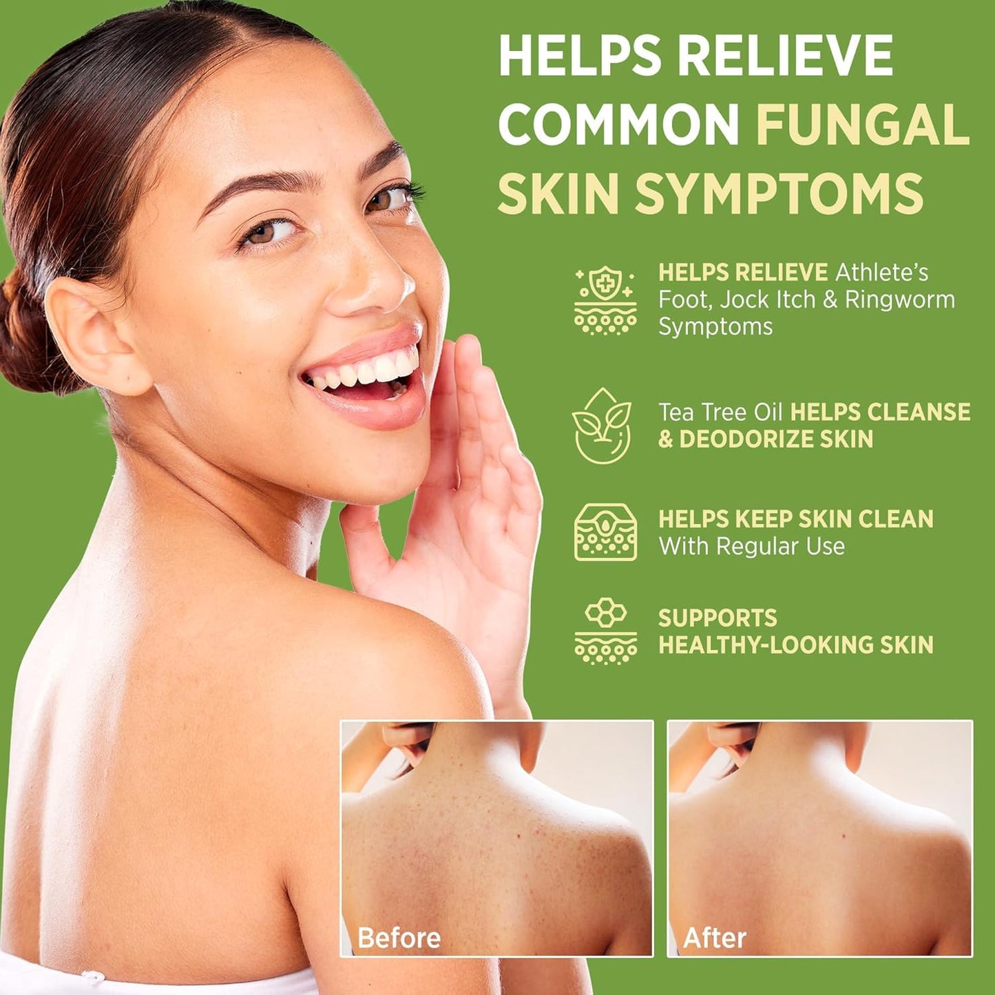 Roycederm Antifungal Bar Soap - Tea tree Oil Soap - Athlete’s Foot Treatment for Jock Itch & Ringworm - Medicated Antifungal Soap with Clotrimazole 1% Beauty & Personal Care Roycederm