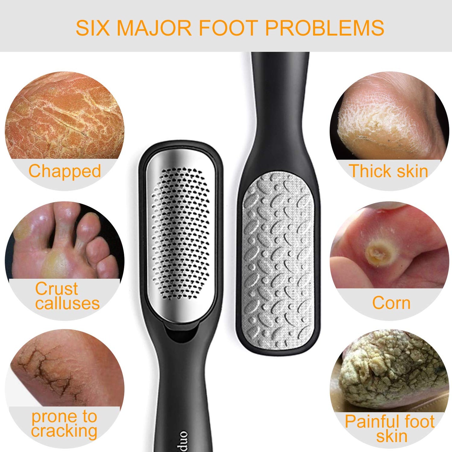 Foot File Callus Remover,Colossal Foot Rasp and Professional Foot Scrubber Pedicure Kit to Remove Hard Skin for Wet and Dry Feet,Surgical Grade