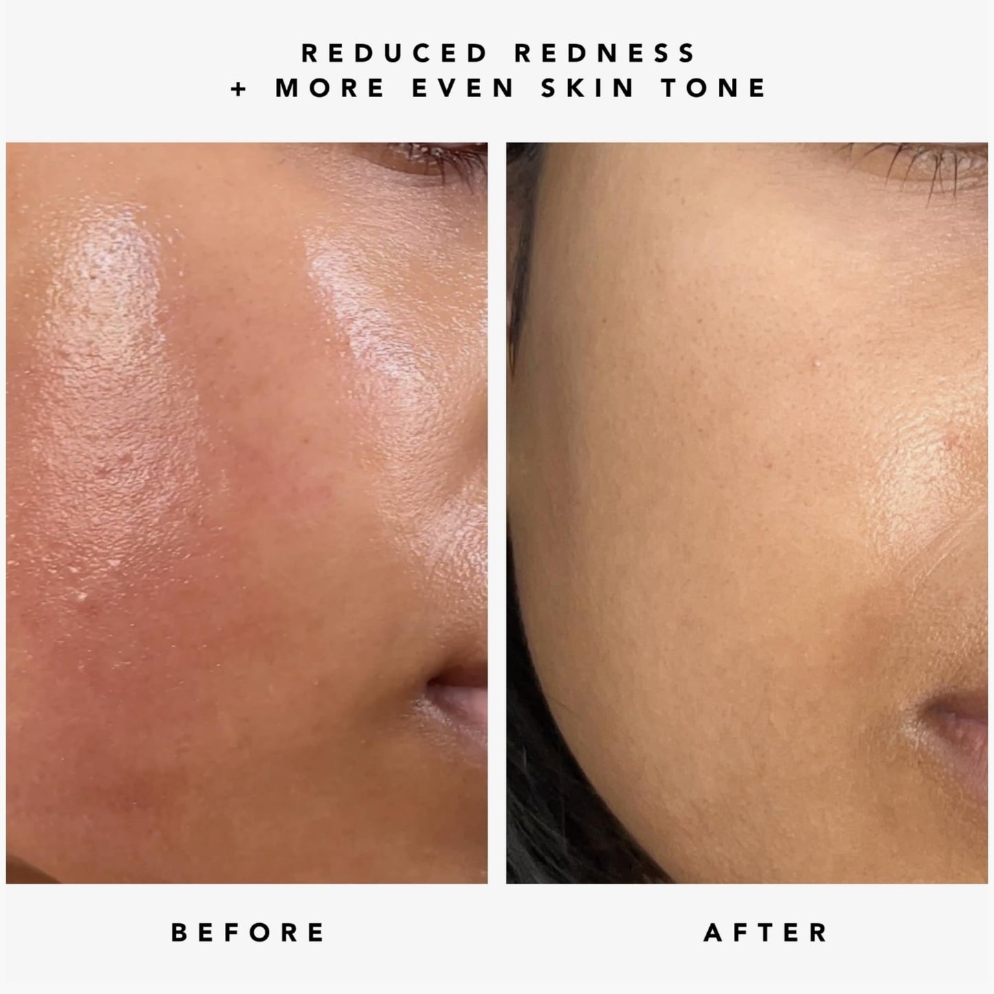 HERBIVORE Nova 15% Vitamin C + Turmeric Brightening Serum for Dark Spots, Hyperpigmentation + Even Skin Tone | Vegan, Plant-Based, Cruelty-Free, 30