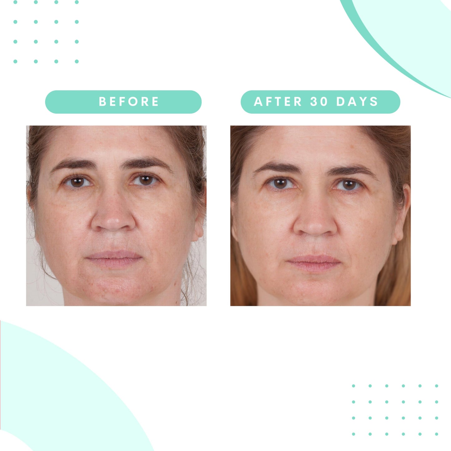 Serious Skincare Glycolic Gommage Extreme Renewal Facial Mask for Radiant Skin - Glycolic Acid - Micro Exfoliation Facial Treatment Mask - Decongest