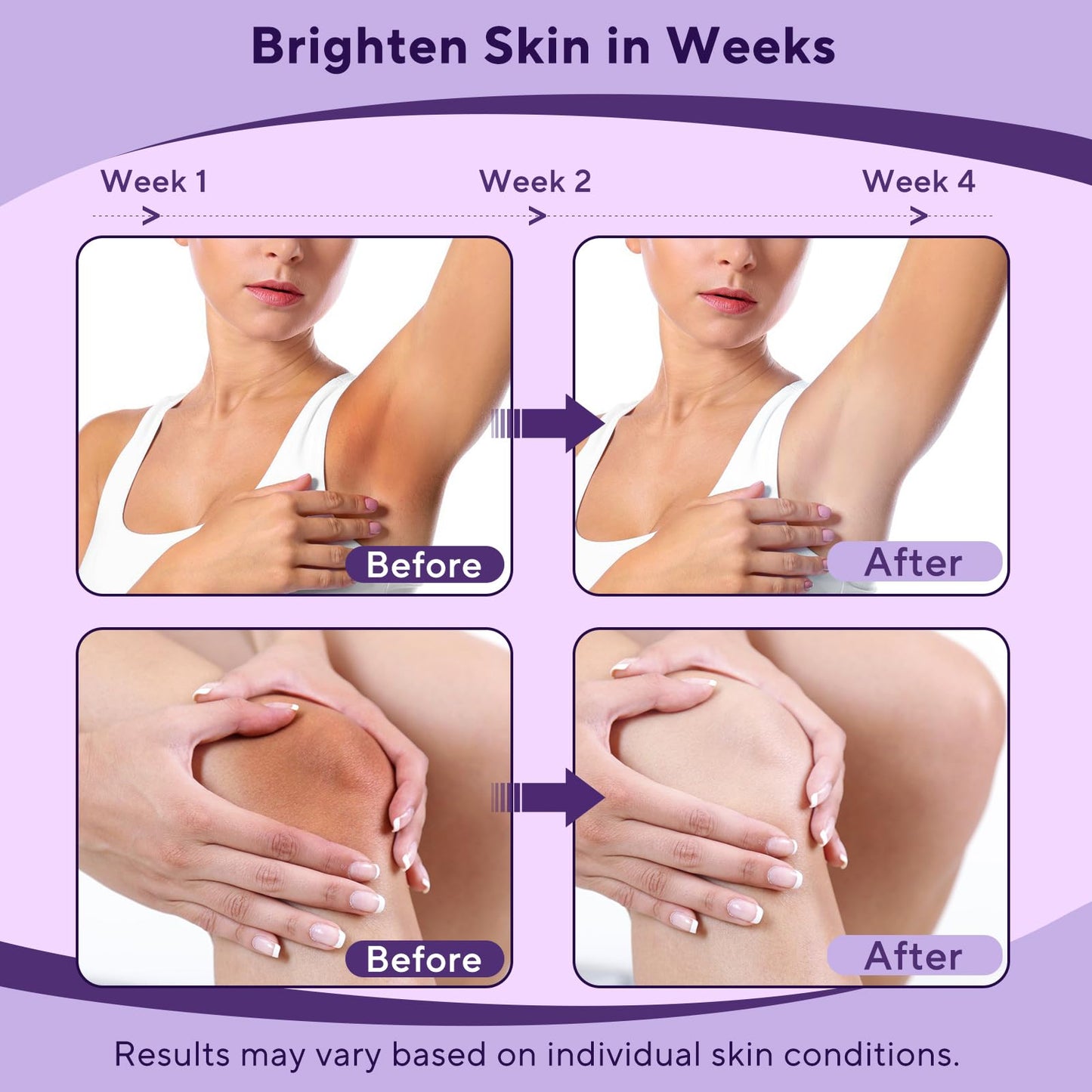 Skin Bleaching Cream, Skin Lightening Cream with Vitamin C for Intimate Areas, Dark Spot Remover for Body, Sensitive, Face, Intimate Areas Underarms