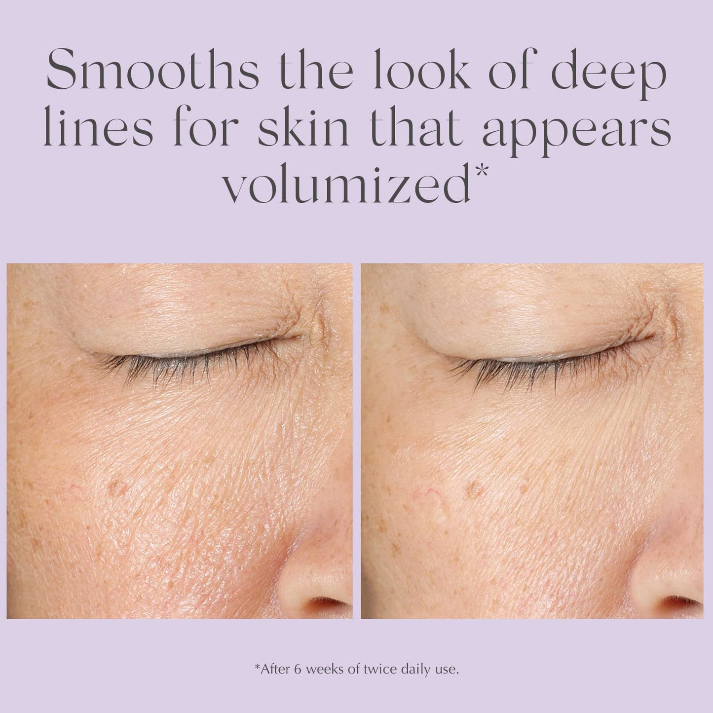 EXUVIANCE Lift Volumizing Concentrate Antiaging Filler Moisturizer For Expression Lines with Hyaluronic Acid and Neoglucosamine, 50 g.