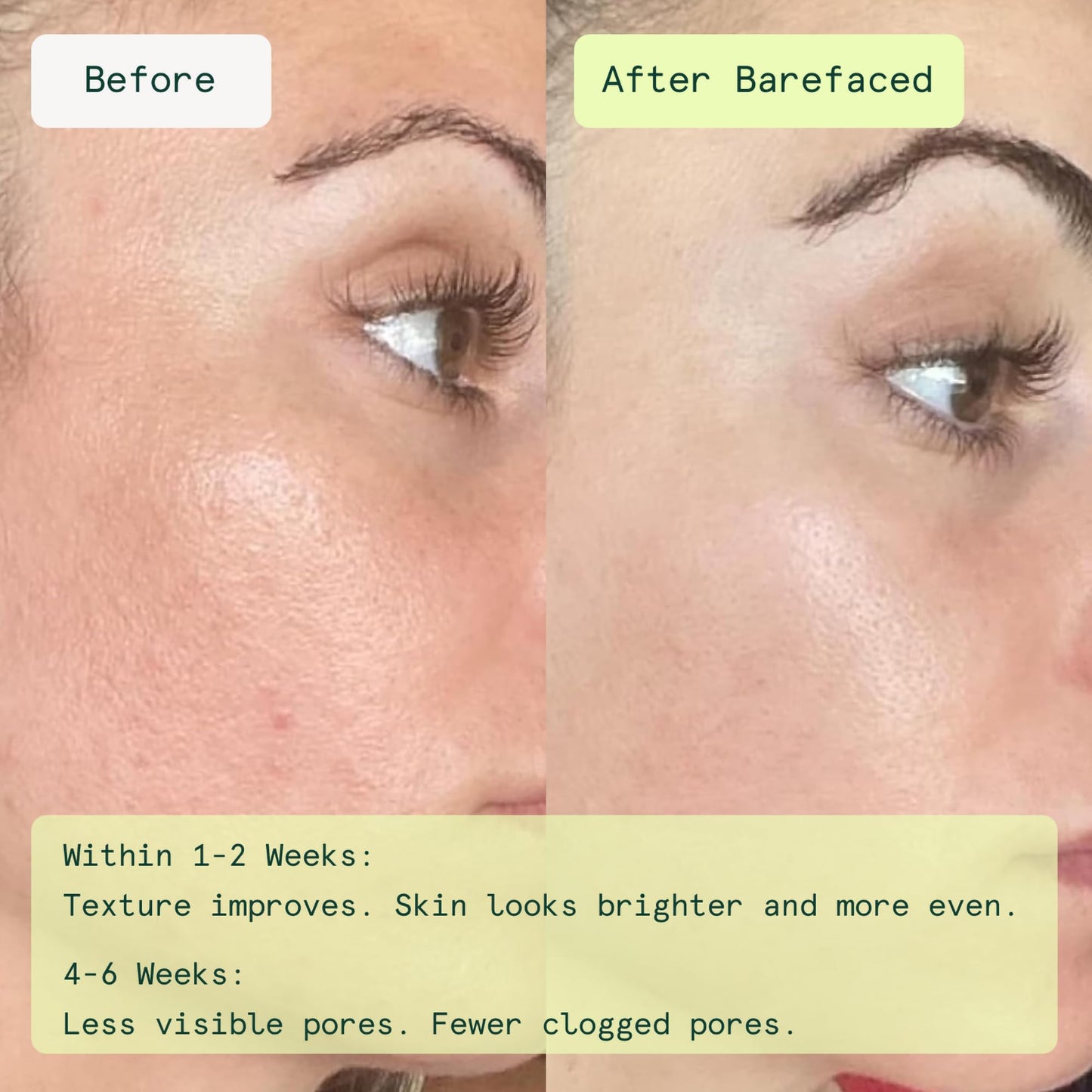 Barefaced Toning and Exfoliating Pads | Glycolic and Salicylic Acid Face Wipes for Blemishes, Dark Spots, and Uneven Texture | Daily Resurfacing Peels Beauty and Personal Care Barefaced