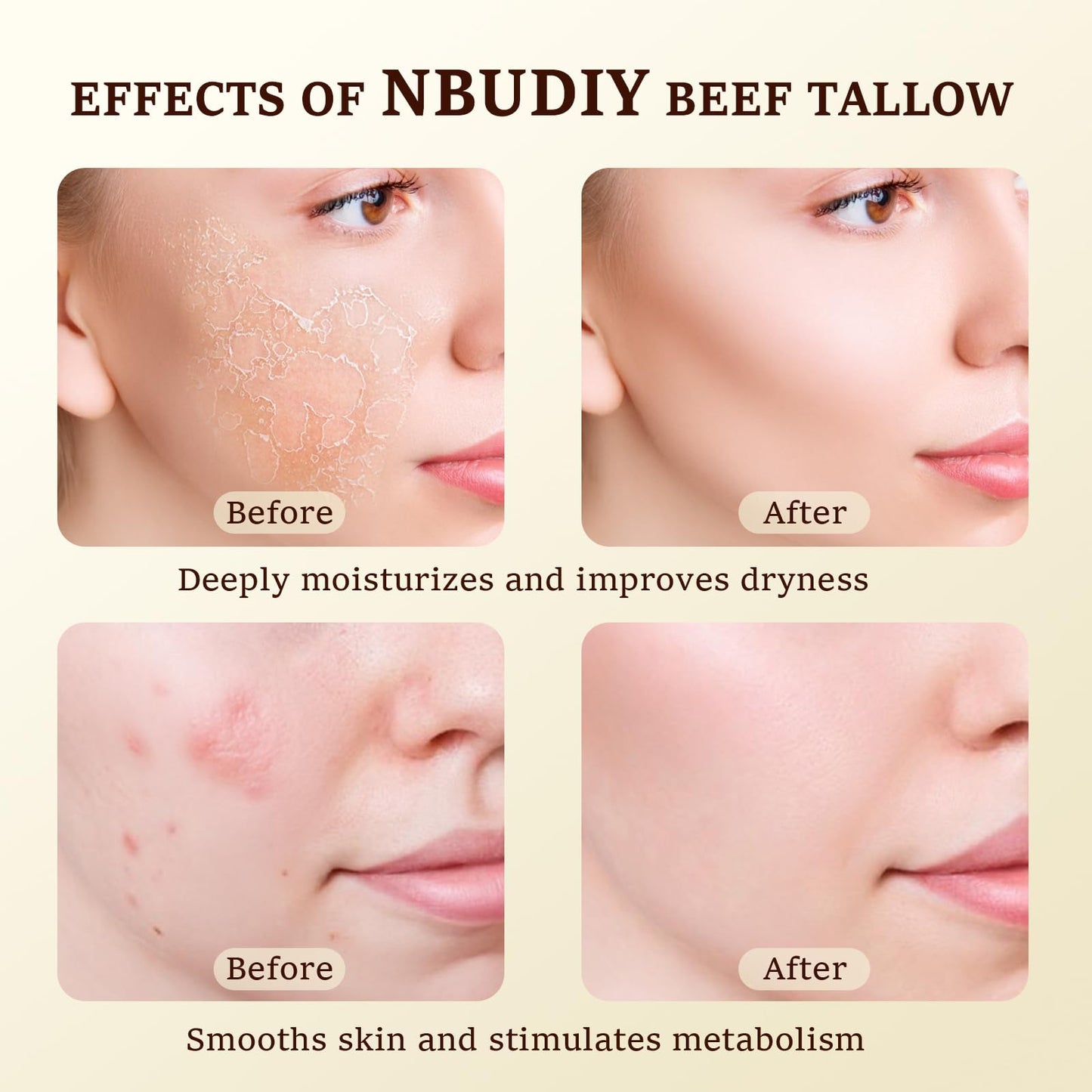 NBUDIY Beef Tallow for Skin, Tallow and Honey Balm, Tallow Face Moisturizer, Grass Fed Beef Tallow for Face - Sensitive Dry Skin Repair, Deeply