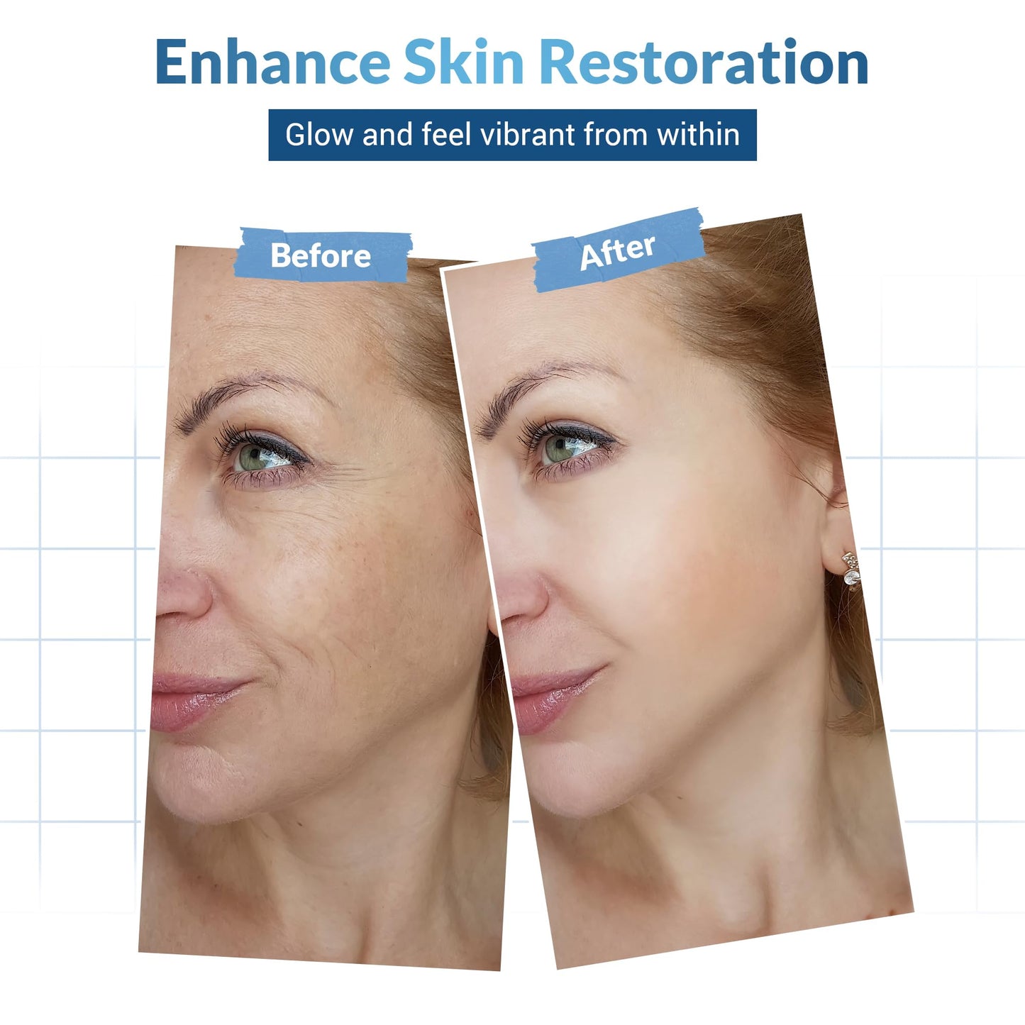 Dermatouch Collagen Eye Cream - Hyaluronic Acid and Caffeine Antioxidant Skin Treatment, Wrinkle Reducer, 1.6 Oz.