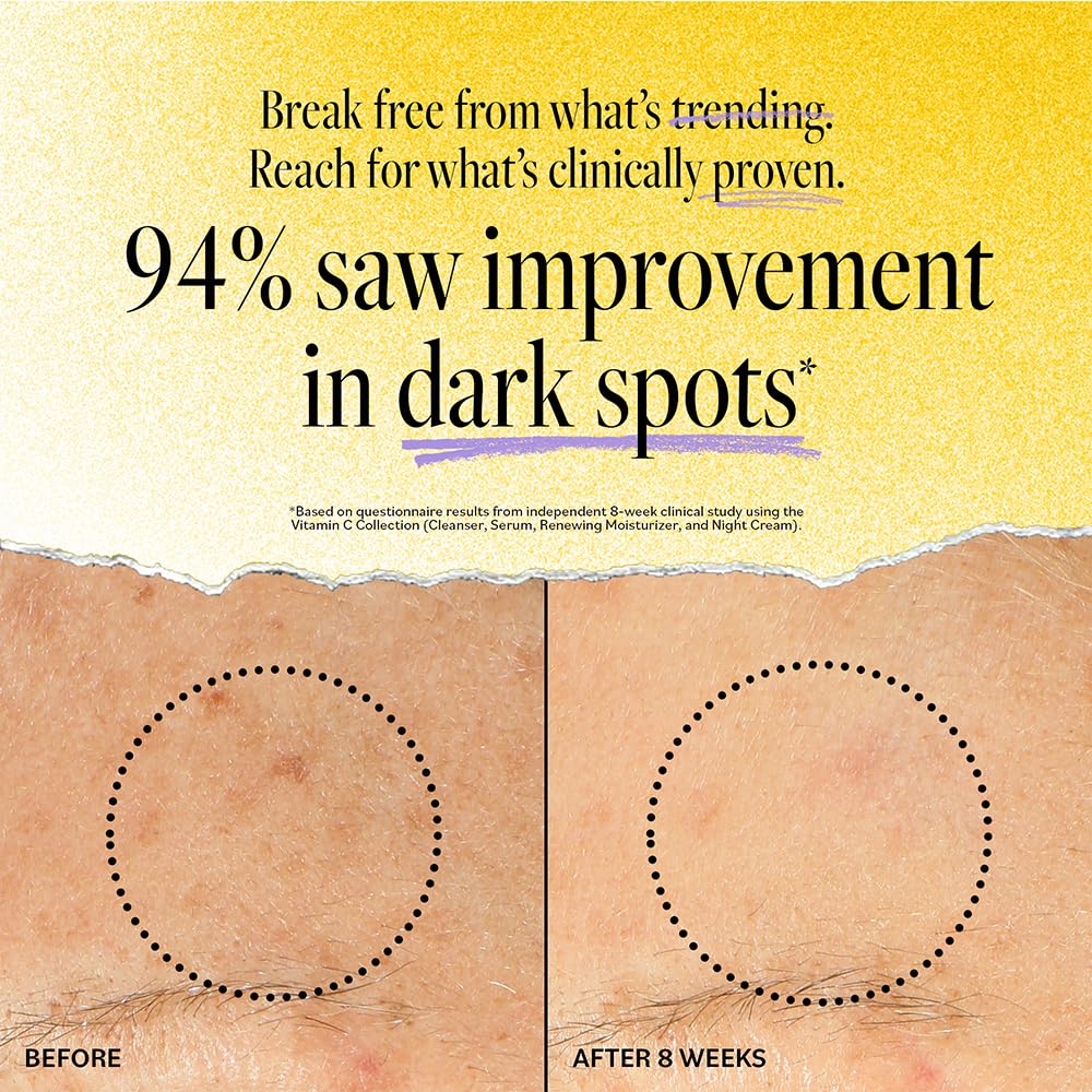 DERMA E Vitamin C Concentrated Serum, 2 Oz, with Hyaluronic Acid, Vitamin E & Aloe, All Natural, Antioxidant-Rich Concentrated Formula, Hydrating