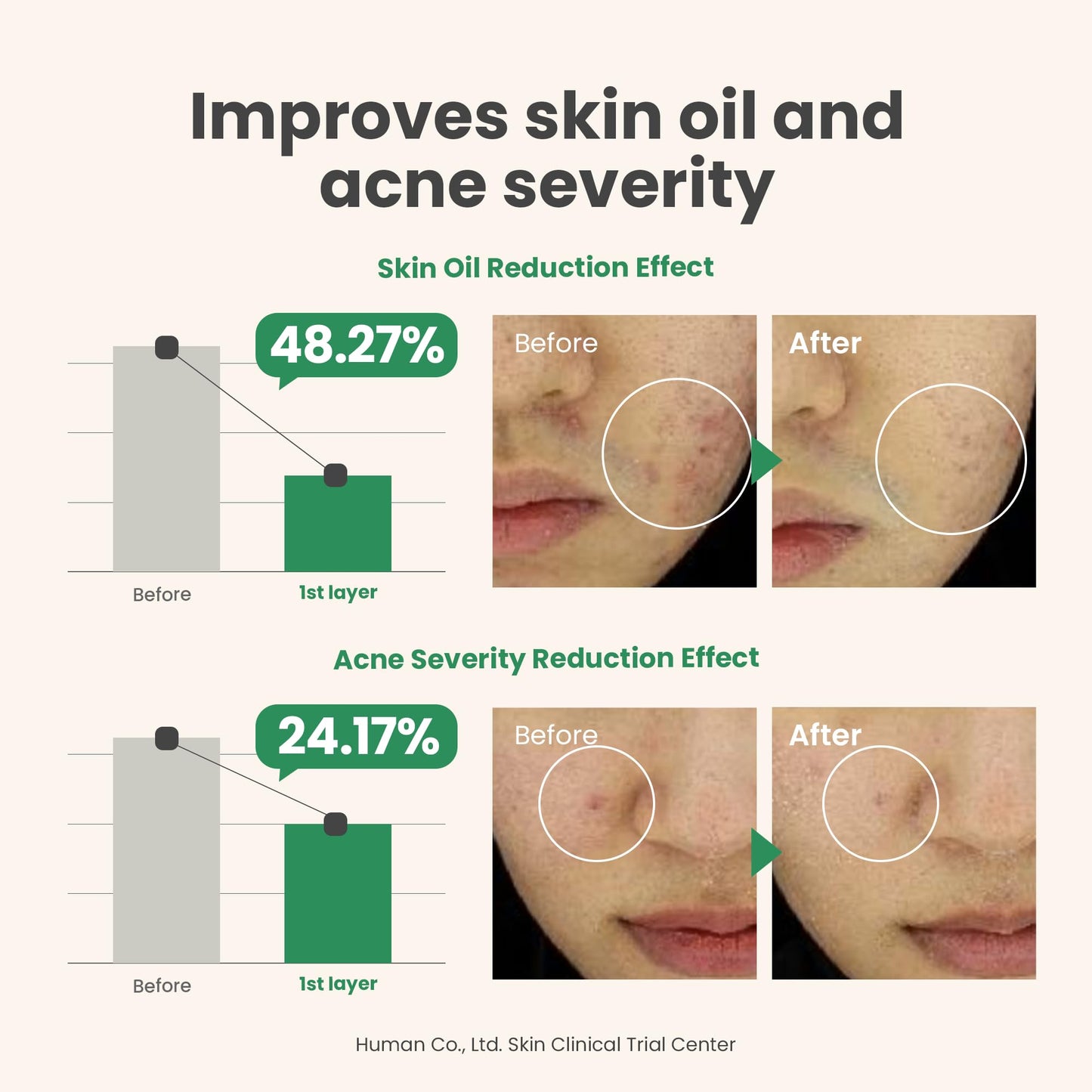 AXIS-Y Spot The Difference Blemish Spot Treatment - 4-Terpineol 2% Niacinamide AHA BHA Soothes Breakouts & Skin Barrier Repair - Vegan Korean Skin