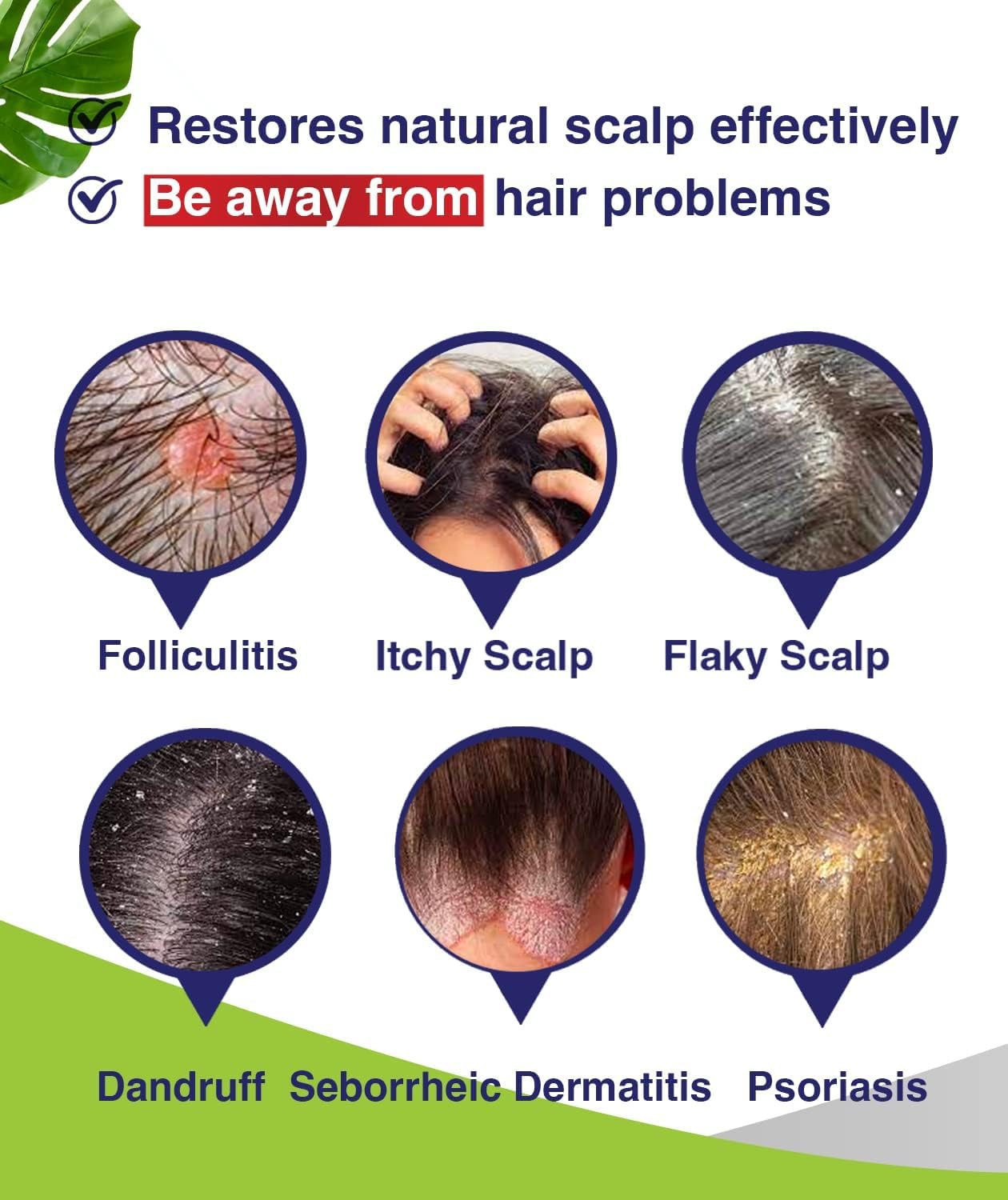 PHARMBANNER Anti-Fungal Shampoo for Itchy, Dry Scalp - Supports Scalp Health, Helps with Folliculitis, Seborrheic Dermatitis & Scalp Flaking-2 Pack