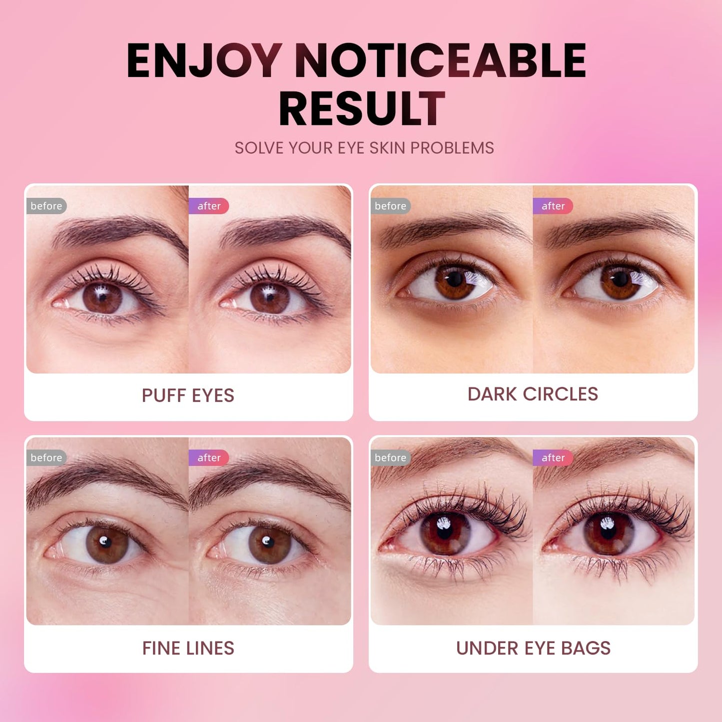 AILEORY Under Eye Patches (36 Pairs) - Tri-color Glitter Eye Gel Pads for Dark Circles, Puffy Eyes, Under eye Bags, Wrinkles | Natural Collagen Under Beauty and Personal Care AILEORY