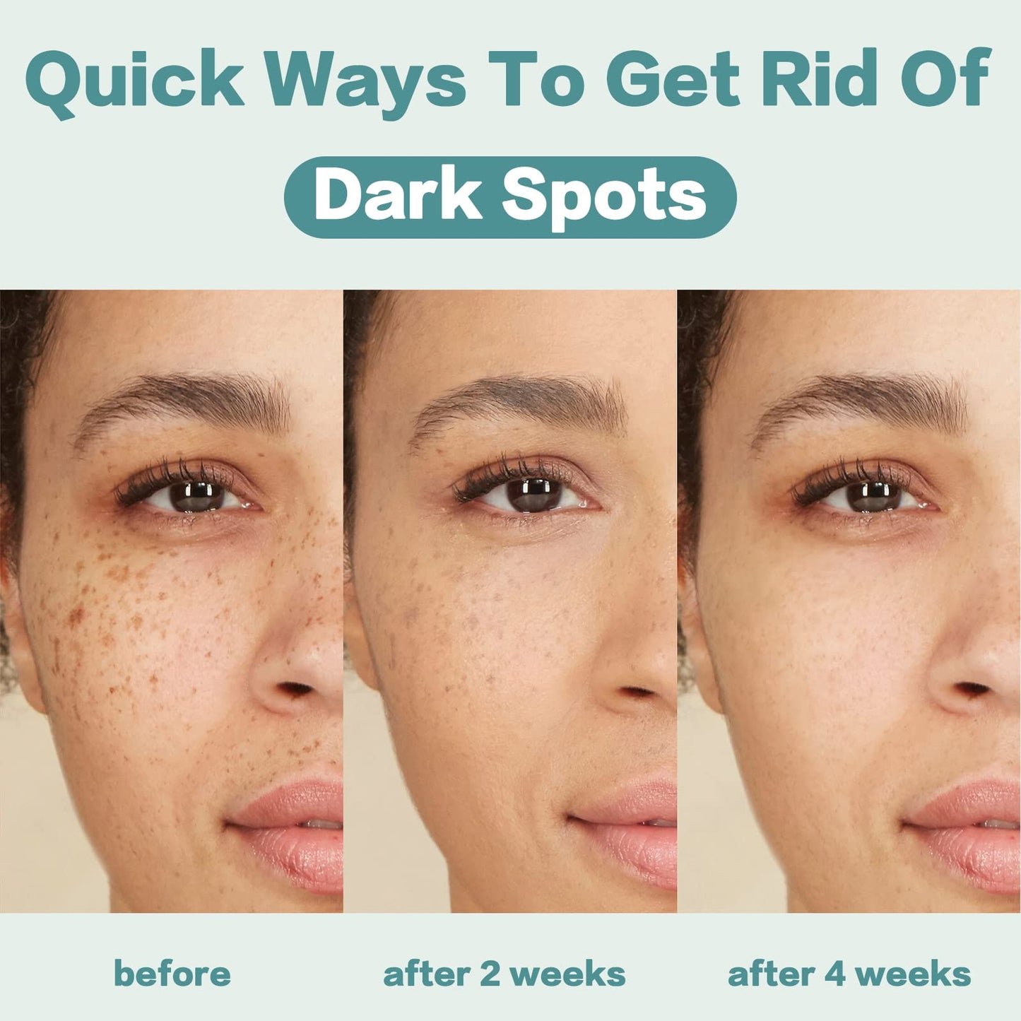 CITYGOO Dark Spot Remover for Face: Dark Spot Corrector Cream - Enriching Skin Care For All Skin Tones - Melasma Freckle Sun Spot Remover & Blemish