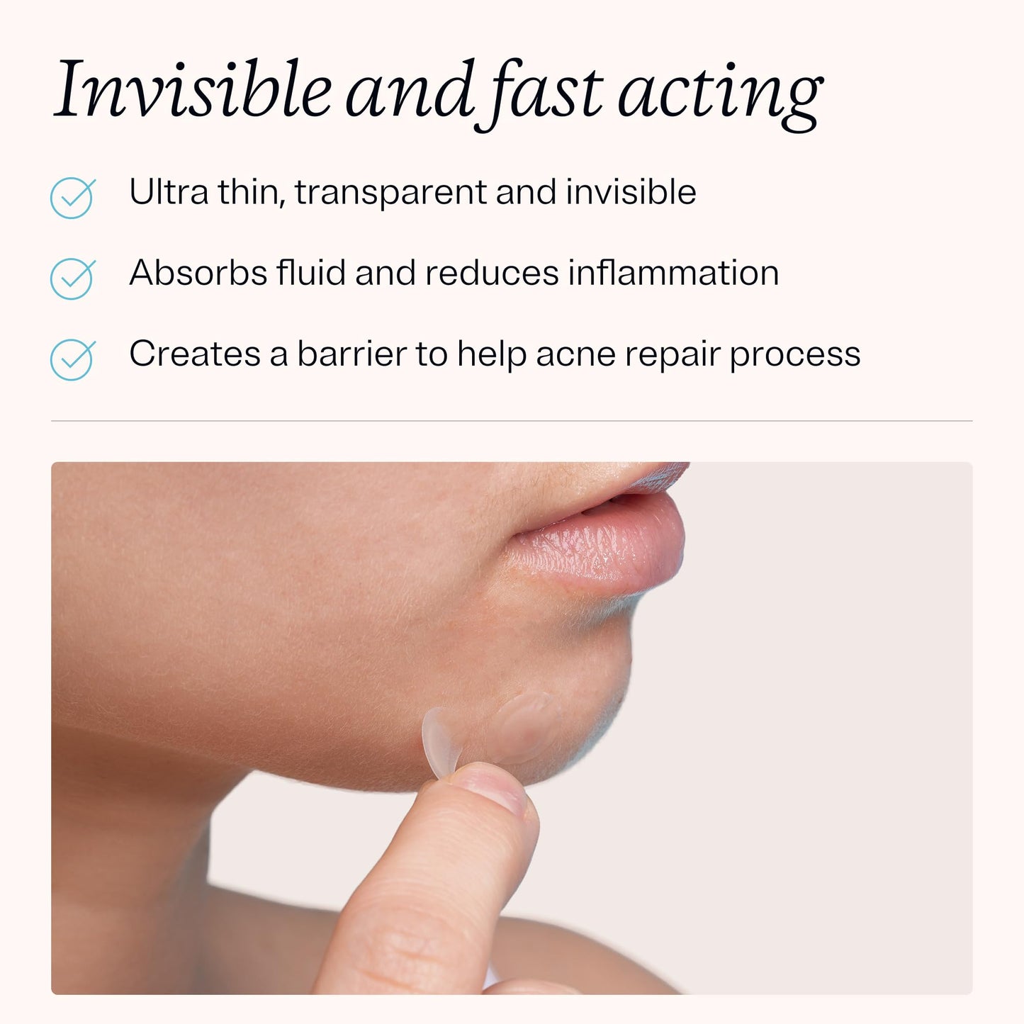 MDacne Pimple Patches for Acne Treatment, Hydrocolloid Patches - Absorbs Oil & Pus from Clogged Pores, Ultrathin & Transparent Blends with All Skin
