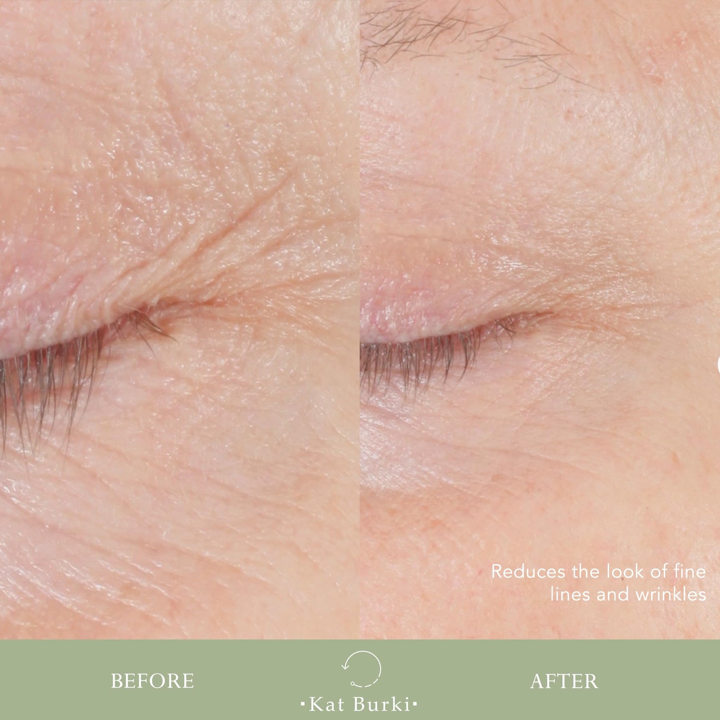 Kat Burki Form Control Marine Collagen Face Serum. Clinically Proven Anti-Aging Care Promoting Collagen Production: Lifts, Plumps & Contours Skin - 1