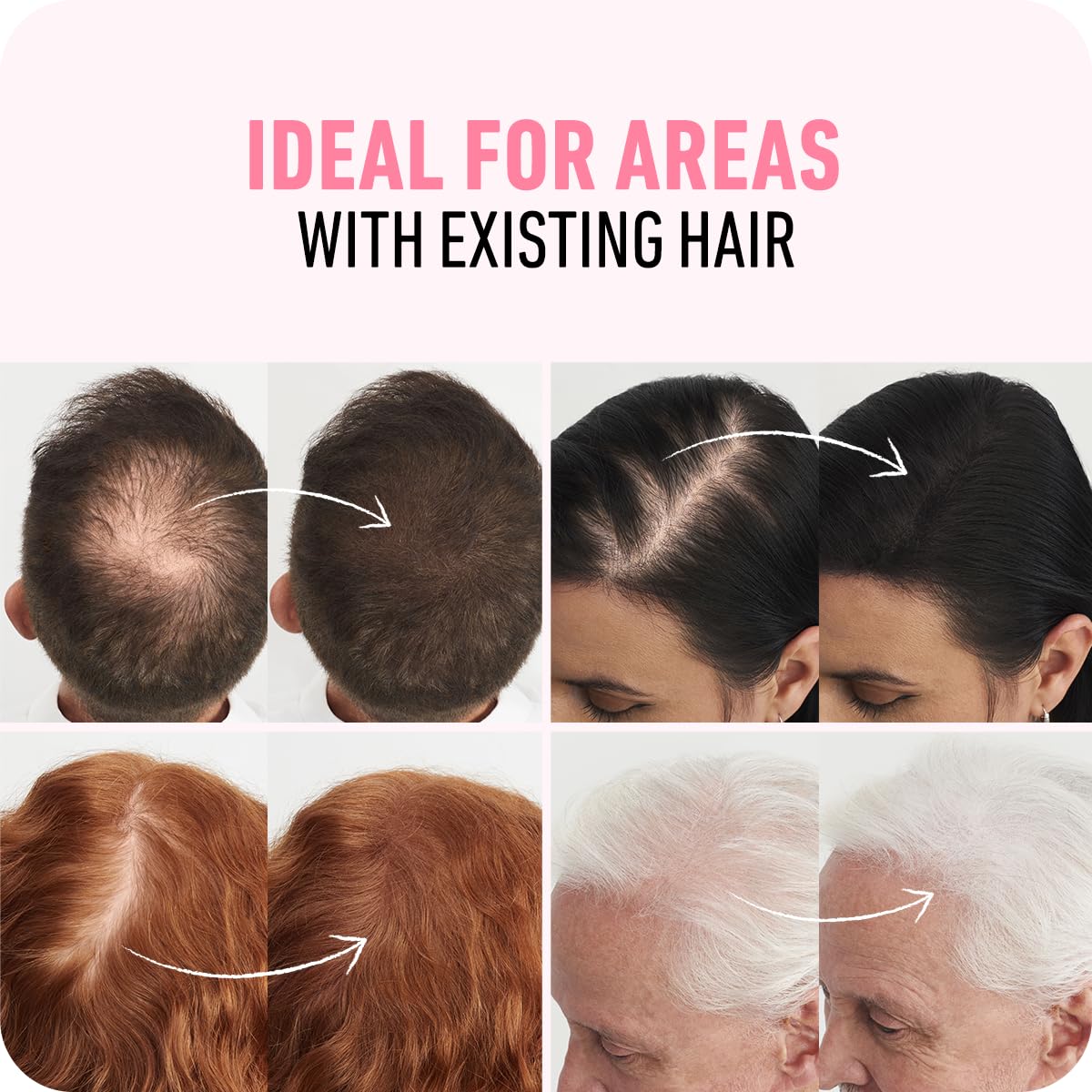 BOLDIFY Hair Fibers - Fill In Thinning and Fine Hair for an Instantly Fuller, Thicker Look - 14 Shades for Women & Men Beauty and Personal Care Boldify