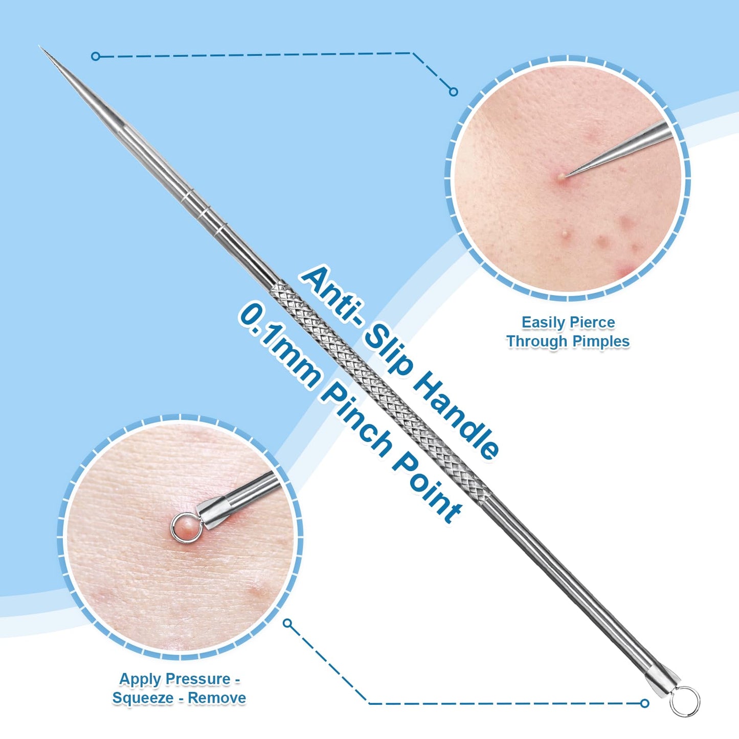 Vybiekr Stainless Steel Blackhead Remover, Pimple Extractor, Pimple Popper, Comedone Extractor, Surgical Grade Acne Treatment Tool, 3rd Generation Beauty and Personal Care Vybiekr