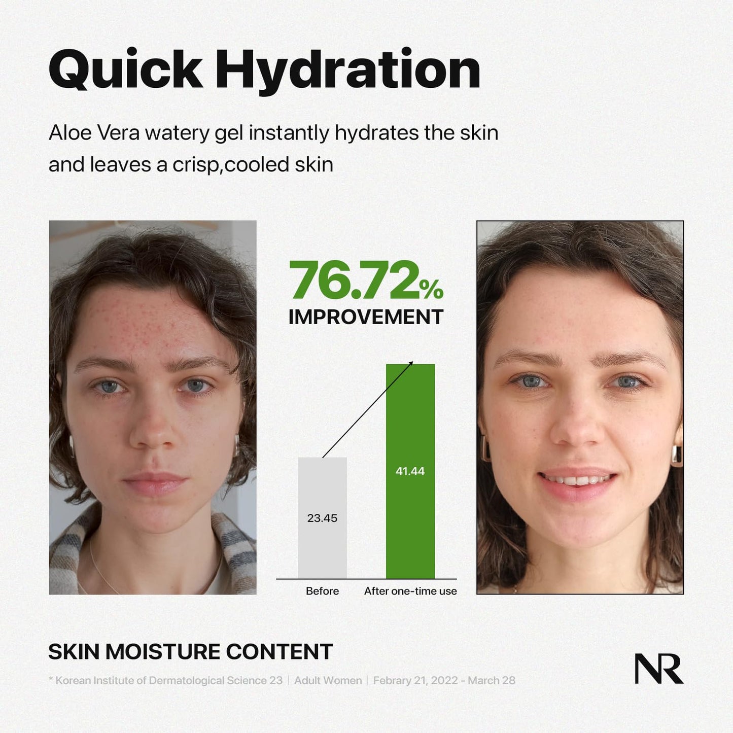 Nature Republic Mild & Moisture Aloe Vera Watery Gel (TUBE) | Quick Hydration & Moisturizing, Fast-Absorbing Non-Sticky Texture, Aftersun Cooling Gel Beauty and Personal Care Nature Republic