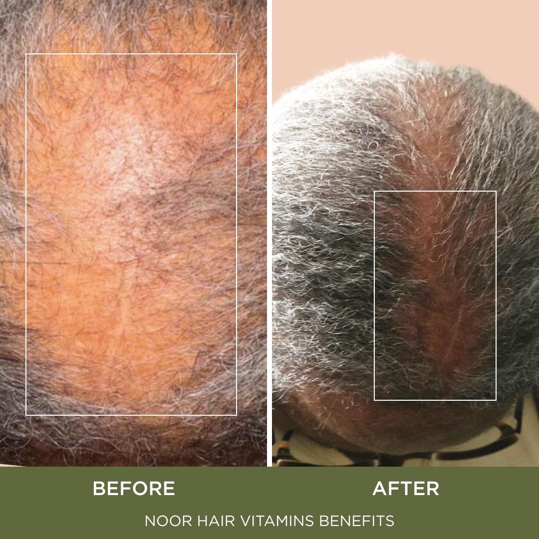 NOOR HAIR Healthy Hair Formula, Hair Growth Supplement Supporting Thick Hair and Fast Hair Regrowth. Vitamin C, B6, Zinc, Propietary Non-GMO & Gluten Beauty and Personal Care NOOR HAIR