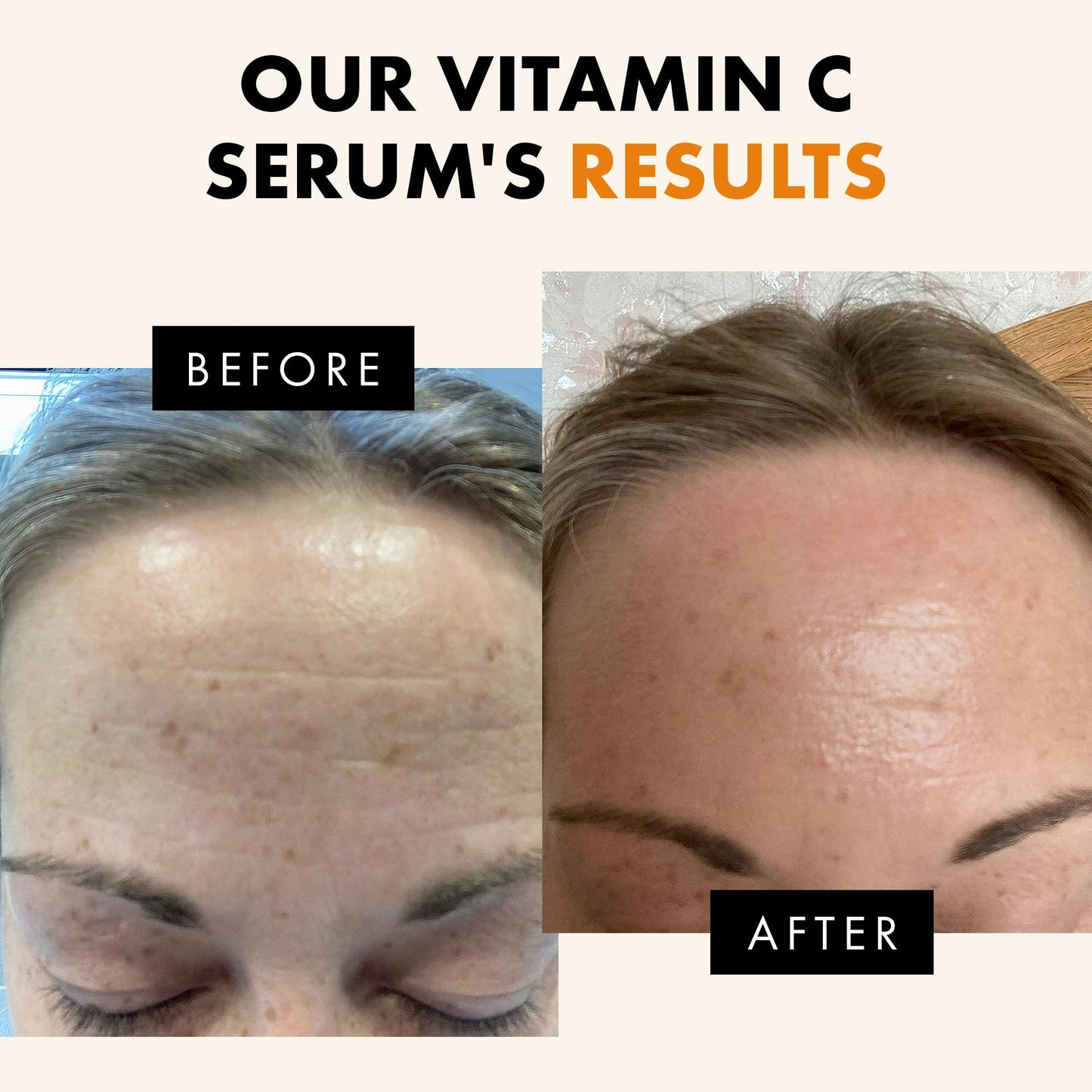 Eclat Skincare Vitamin C Serum - Skin Care for Dark Spots, Vitamin C Serum for Face with Hyaluronic Acid, Ferulic Acid, & Vit E - Anti Aging and Skin Beauty and Personal Care Eclat Skincare