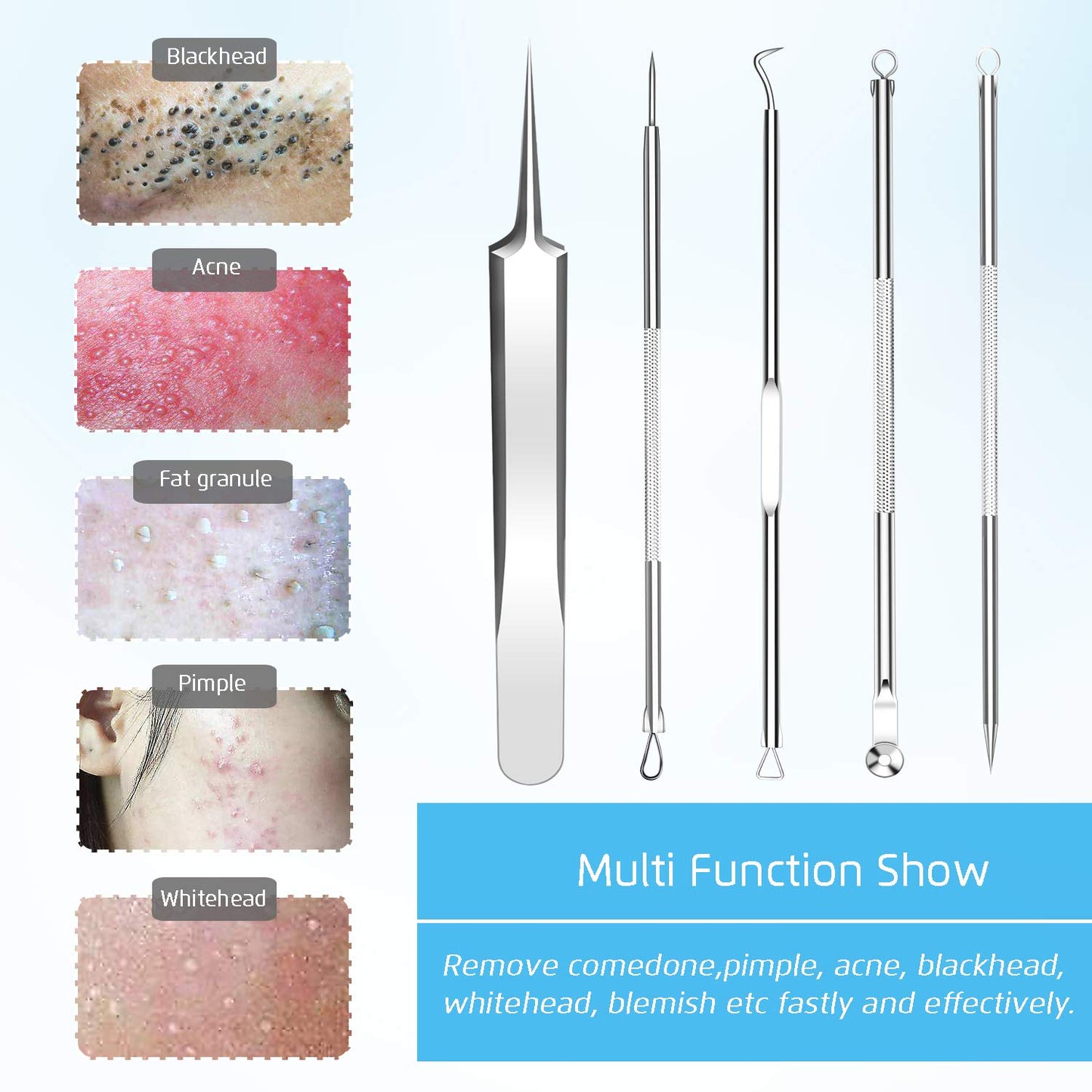 Best Blackhead Remover, Blackheads Blemish Removing, Acne Whitehead Removal Kit, Pimple Comedone Extractor Tool, Popper Pimples Treatment,