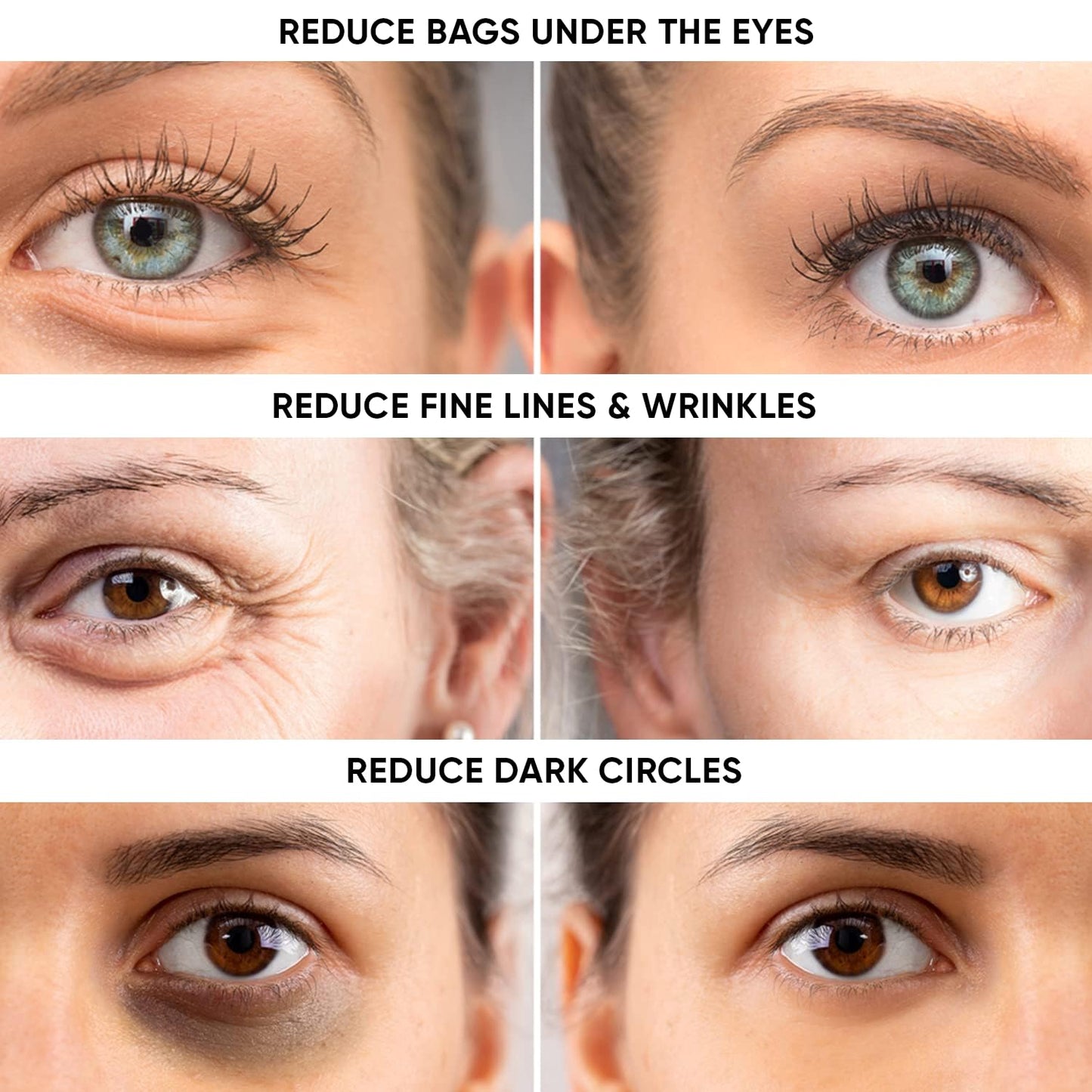 Instant Eye Tightener Cream - Reduces Under Eye Puffiness, Bags, Dark Circles. Lift Technology to Tighten & Firm Sagging Skin Around Eyes. Smooths
