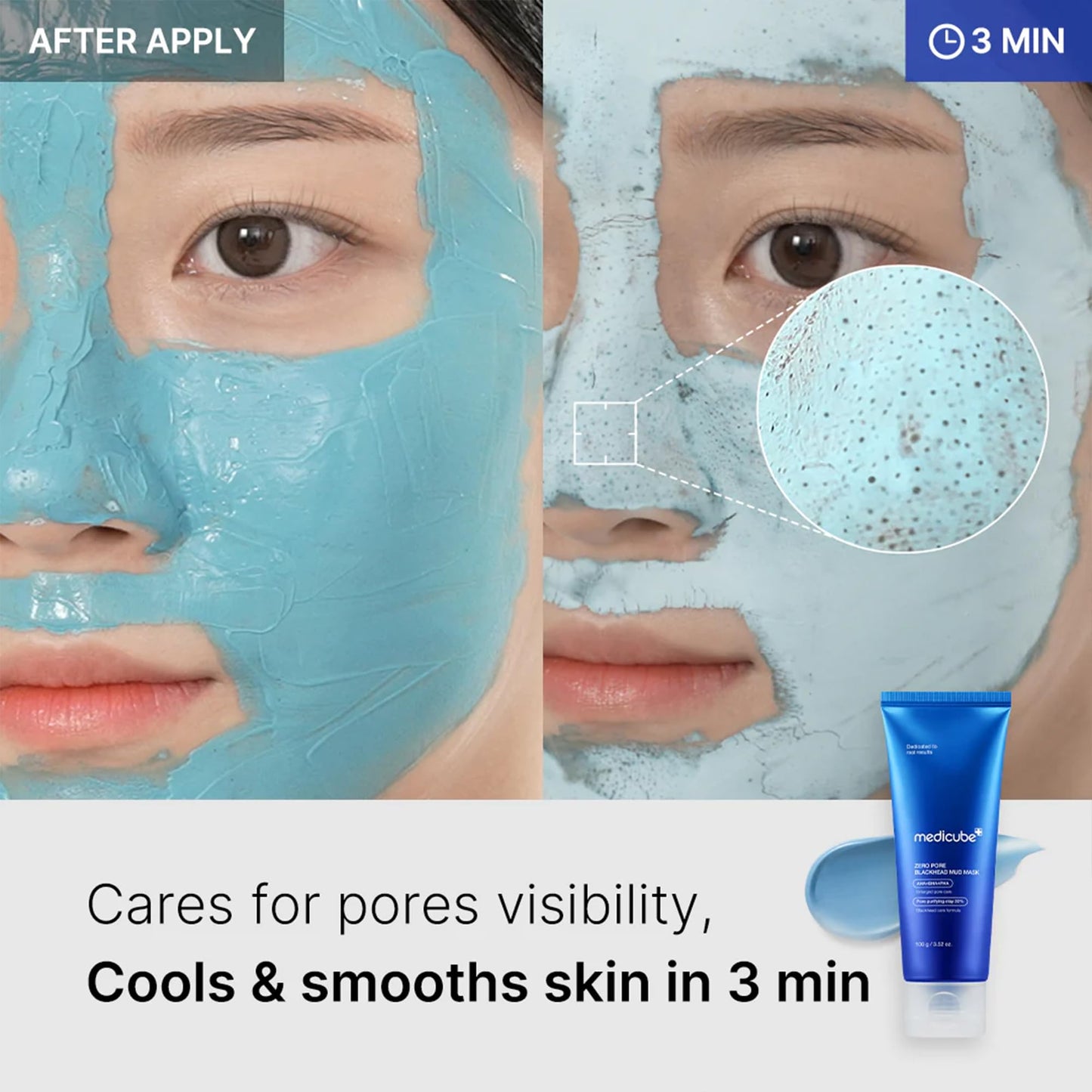 medicube Zero Pore Blackhead Mud Facial Mask - Skin Cooling & Pore Tightening - 3 Minute Quick Dry Formula with AHA, BHA, PHA, and Pore-Purifying Clay Beauty and Personal Care medicube