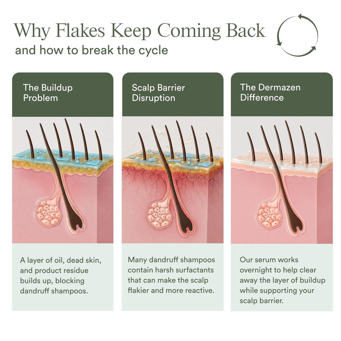 Dermazen Calming Seborrheic Serum For Malassezia-Prone Scalp & Skin 4oz Beauty & Personal Care Dermazen