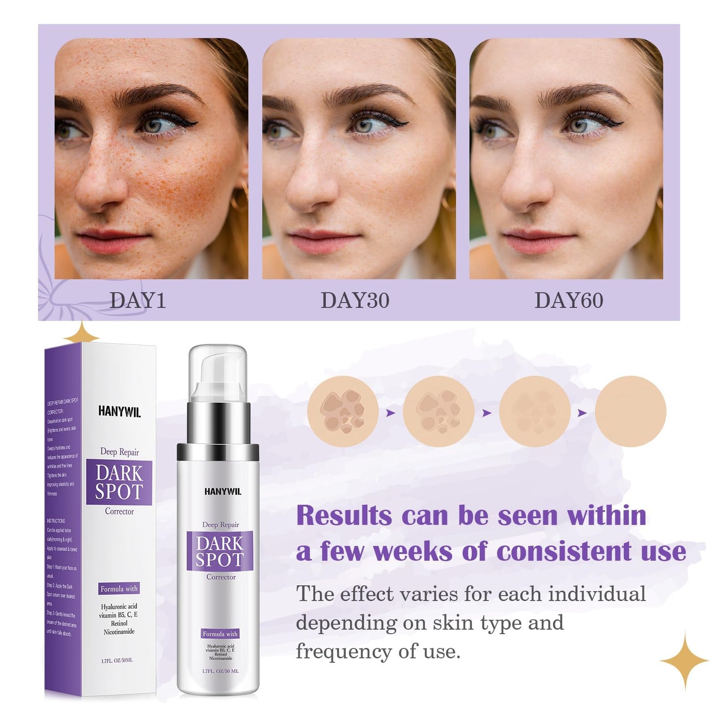 HANYWIL Dark Spot Remover for Face & Body Serum - 2% Retinol + 5% Niacinamide + Vitamin C for Face & Body, Melasma & Hyperpigmentation