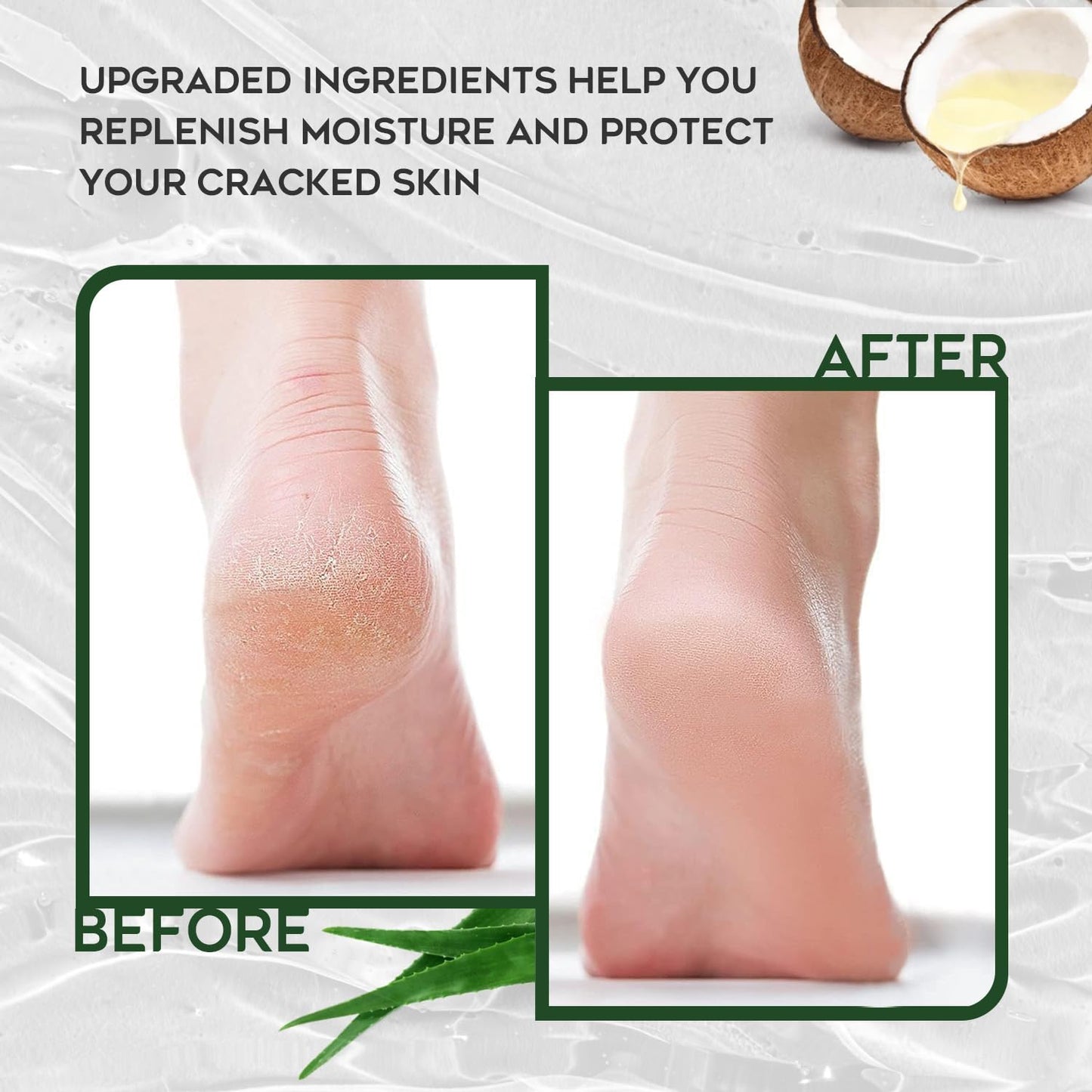 Vebuni Urea Cream 42% Foot Cream Salicylic Acid 4 Oz, Upgraded Callus Remover For Feet, Knees& Elbows, Intensive Moisturizes & Softens Skin