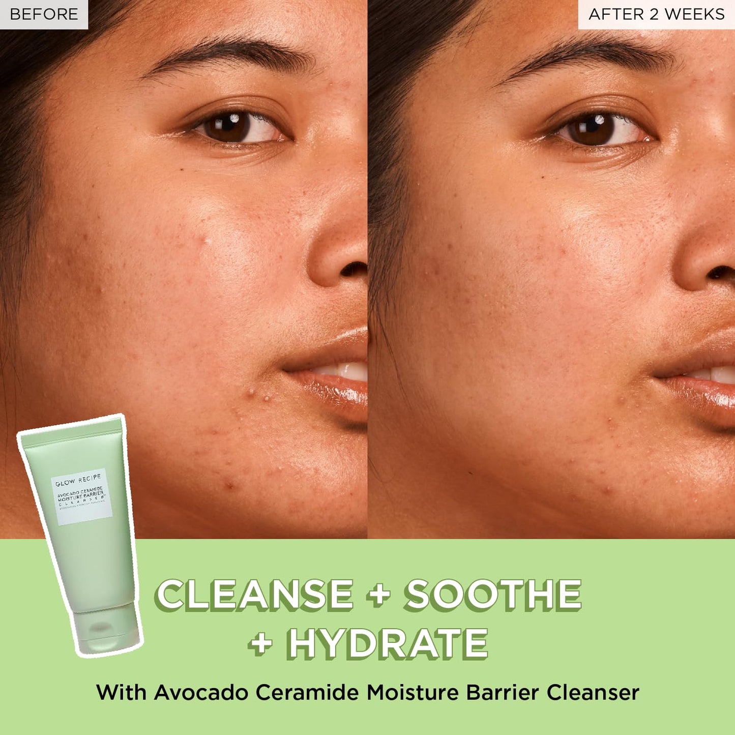 Glow Recipe Avocado Ceramide Facial Cleanser, Korean Double Cleanse Second Step, Hydrating Gel-to-Foam Face Wash for Dry Skin, Barrier Support