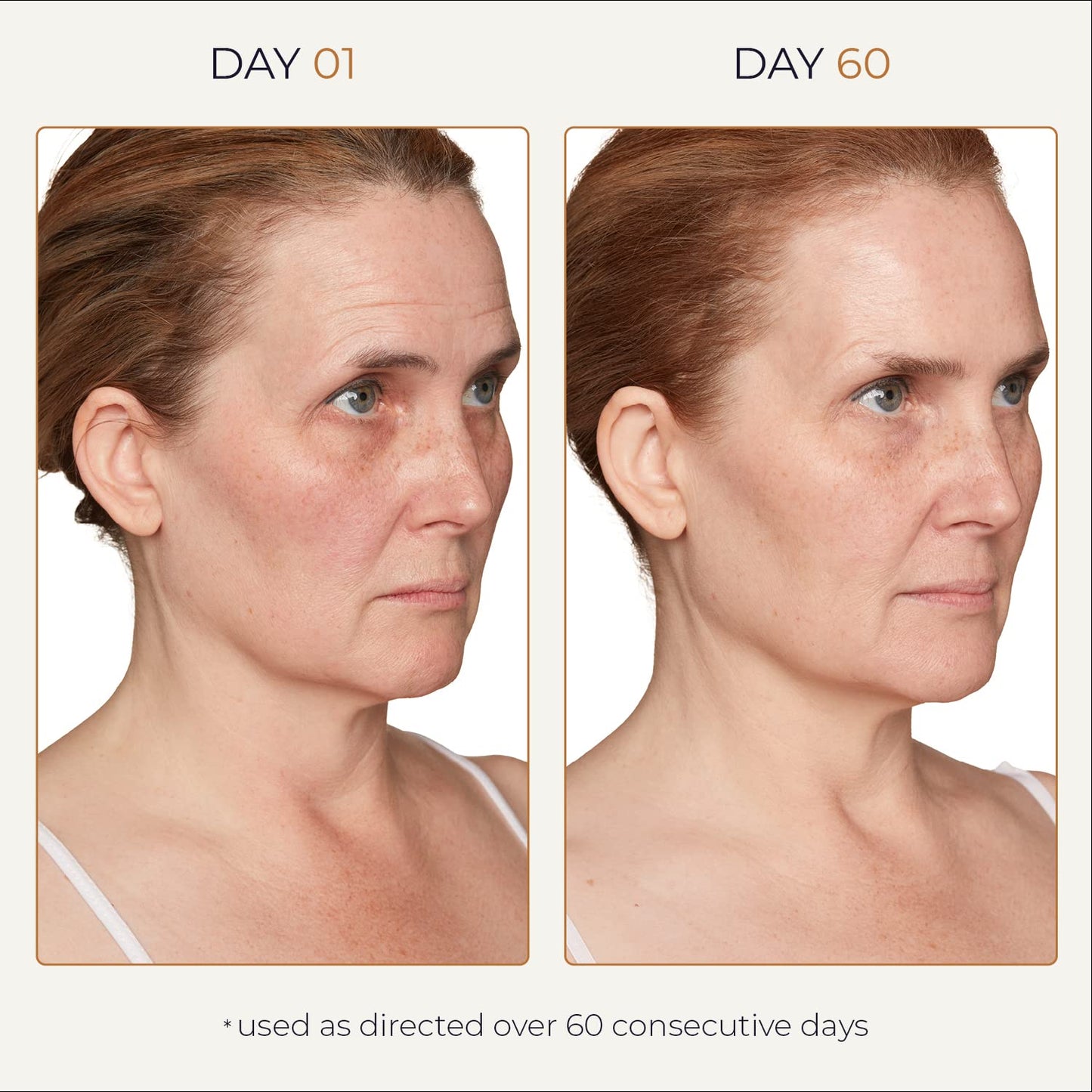 Tru Alchemy Spot Check Dark Spot Remover For Face - Niacinamide, Hyaluronic Acid, Lactic & Glycolic Acid Serum - Age Spot Remover for Face for Women