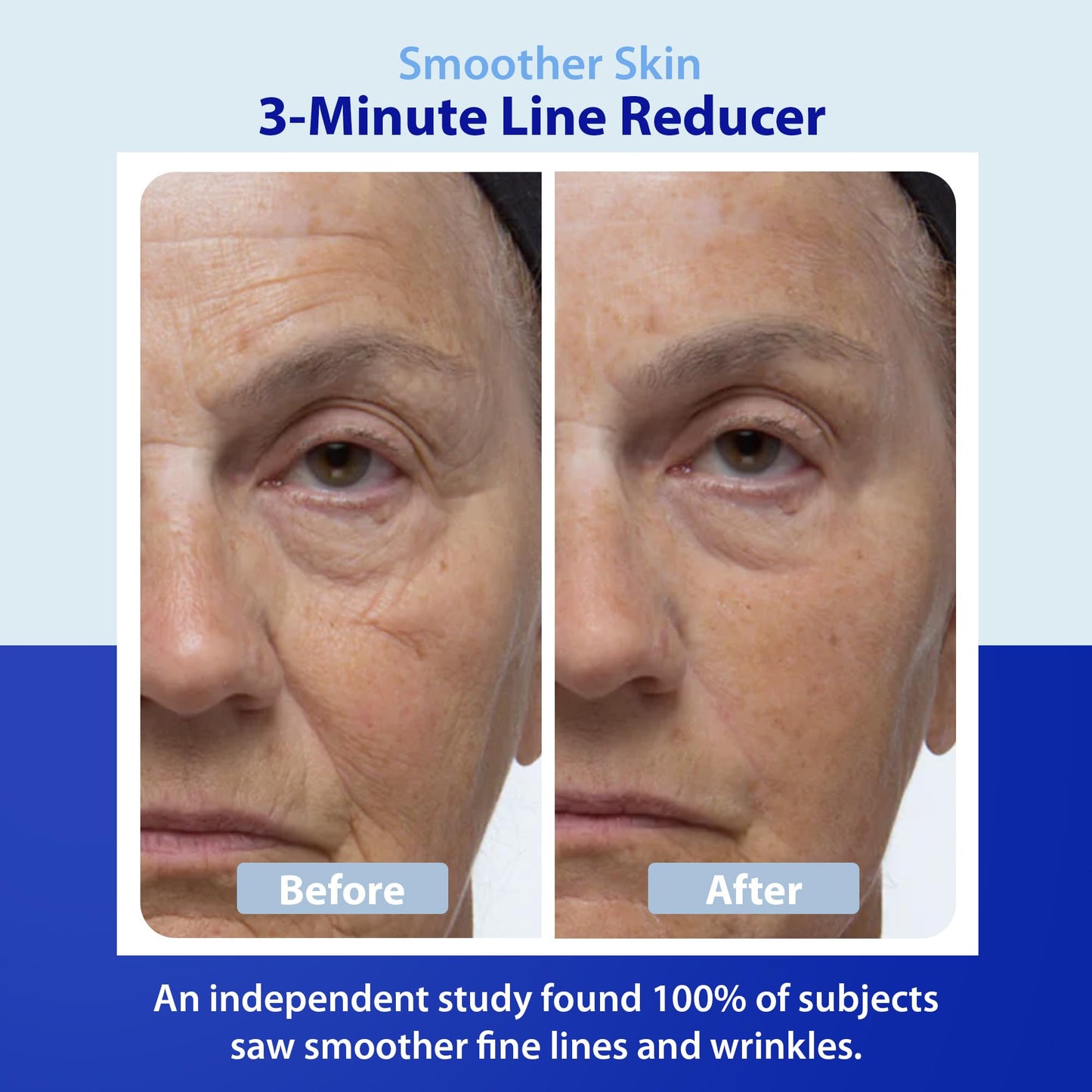 Dr. Denese Wrinkle Lost Line Reducer 1 oz - Hydrating Serum with Silk Protein Fiber Technology for a Smoother Appearance - Lightweight Daily Formula