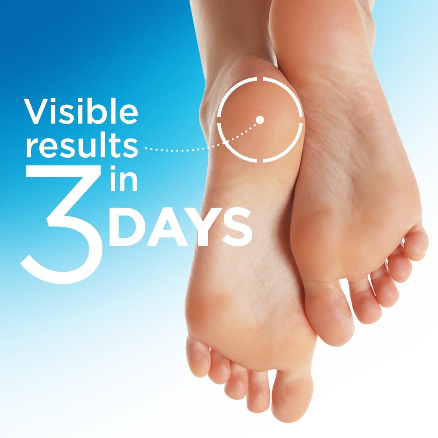Flexitol Heel Magic For Dry Skin or Rough Heels with Shea Butter & Vitamin E, 2.5 Ounce