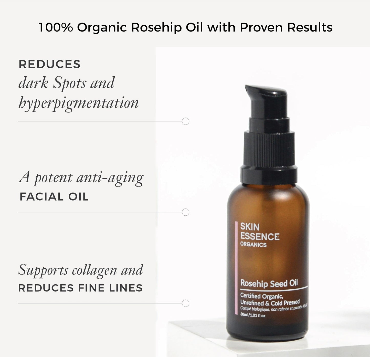 Skin Essence Organics Rosehip Seed Oil - Authentic, Cold-Pressed, & Certified Organic (30ml)