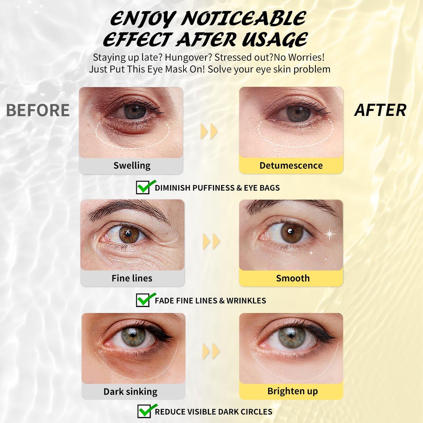 Maskiss Under Eye Patches (25 Pairs), Hyaluronic Acid Eye Masks for Dark Circles Puffy Eyes Undereye Bags, Collagen Eye Patches for Wrinkles