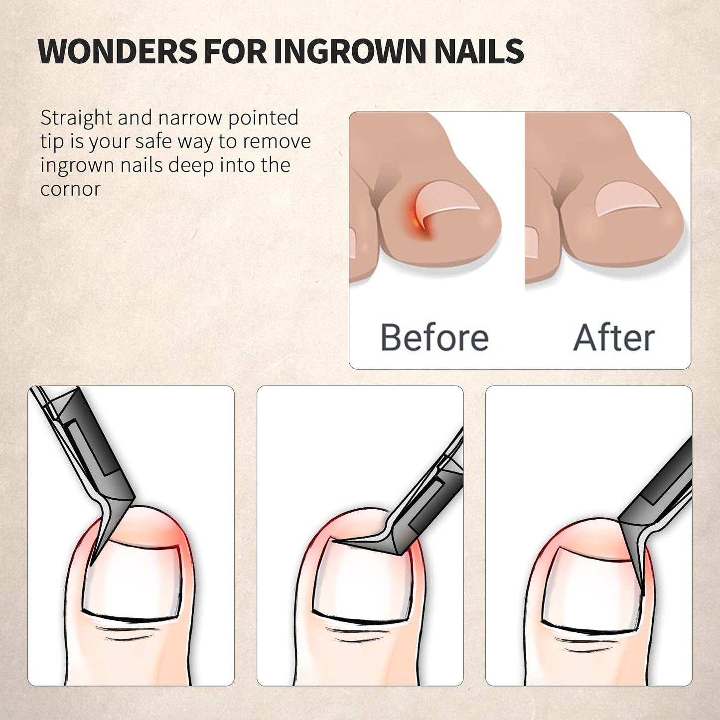 FERYES Toenail Clipper Straight Blade for Ingrown and Thick Nails - Stainless Steel and Sharp Pointed Tip Ingrown Nail Clipper - Wide Jaw Toe Nail Beauty and Personal Care FERYES