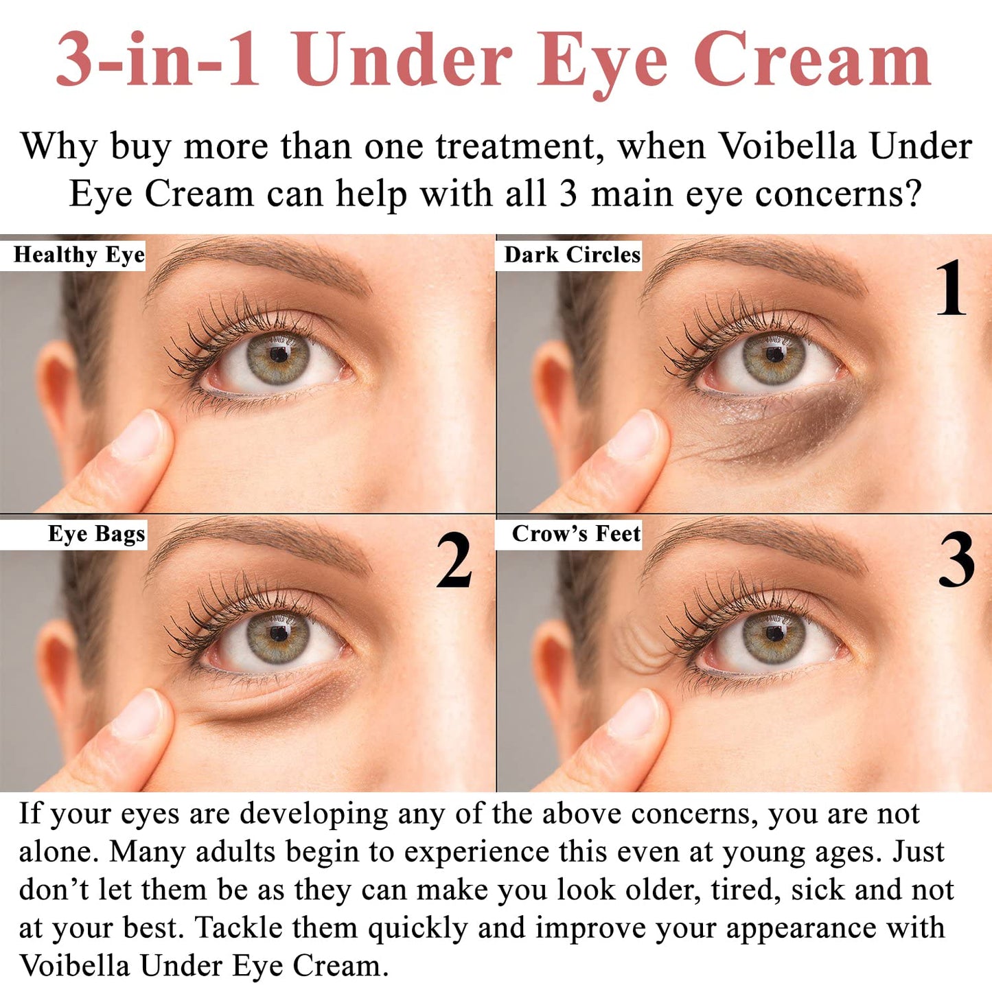 Under Eye Cream with Retinol, Peptides, Hyaluronic Acid & Aloe - Advanced Repair Formula for Puffiness, Bags, Dark Circles & Dry Under Eyes - Best
