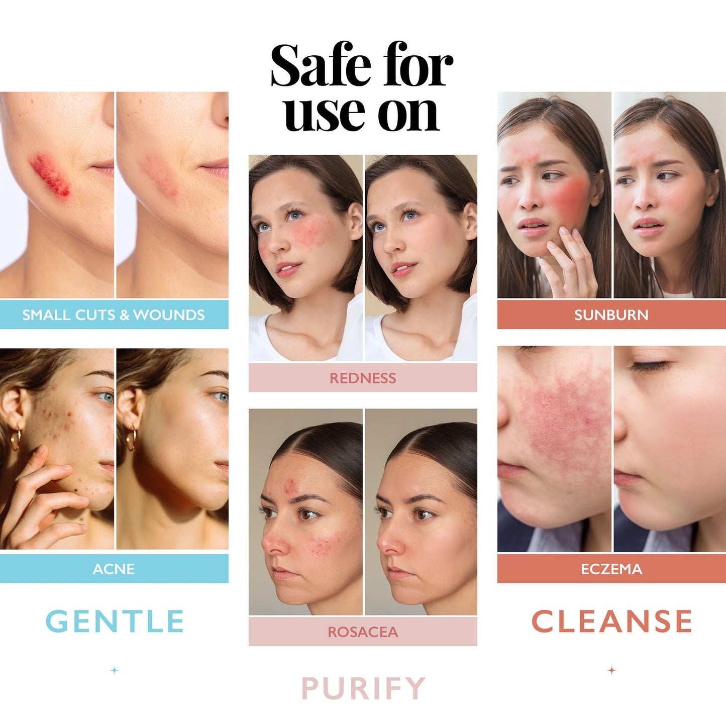 Hypochlorous Acid Spray for Face and Skin; Facial Cleanser | 32oz Refill Face Mist Hypochlorous Acid Spray for Skin, Acne, Rash, Eczema, Wound | Beauty and Personal Care Aquia