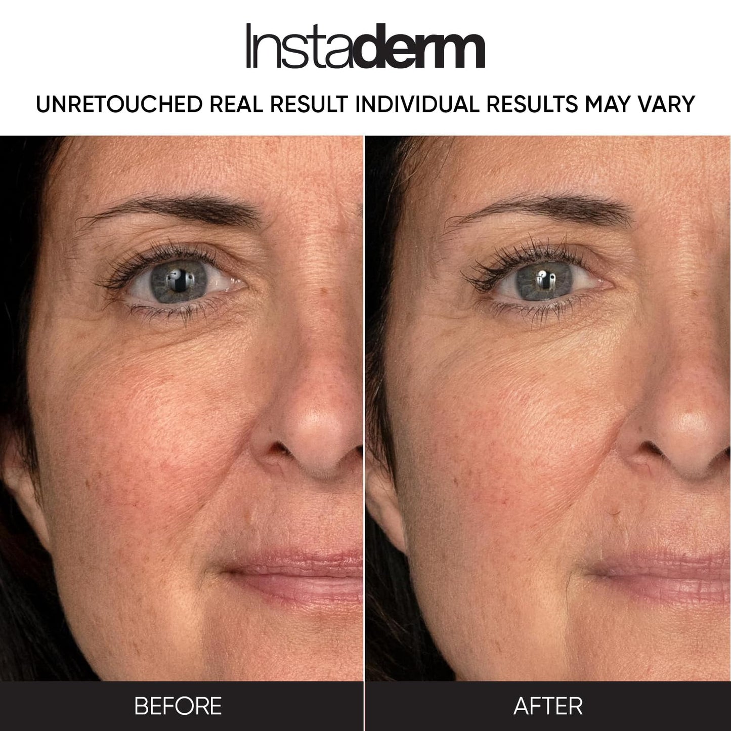 Anti-Aging Resurfacing Pads - Smooth’s Fine Lines, Wrinkles, Dark Spots & Skin Roughness to Enhance the Skins Texture & Tone for Radiant Glow.